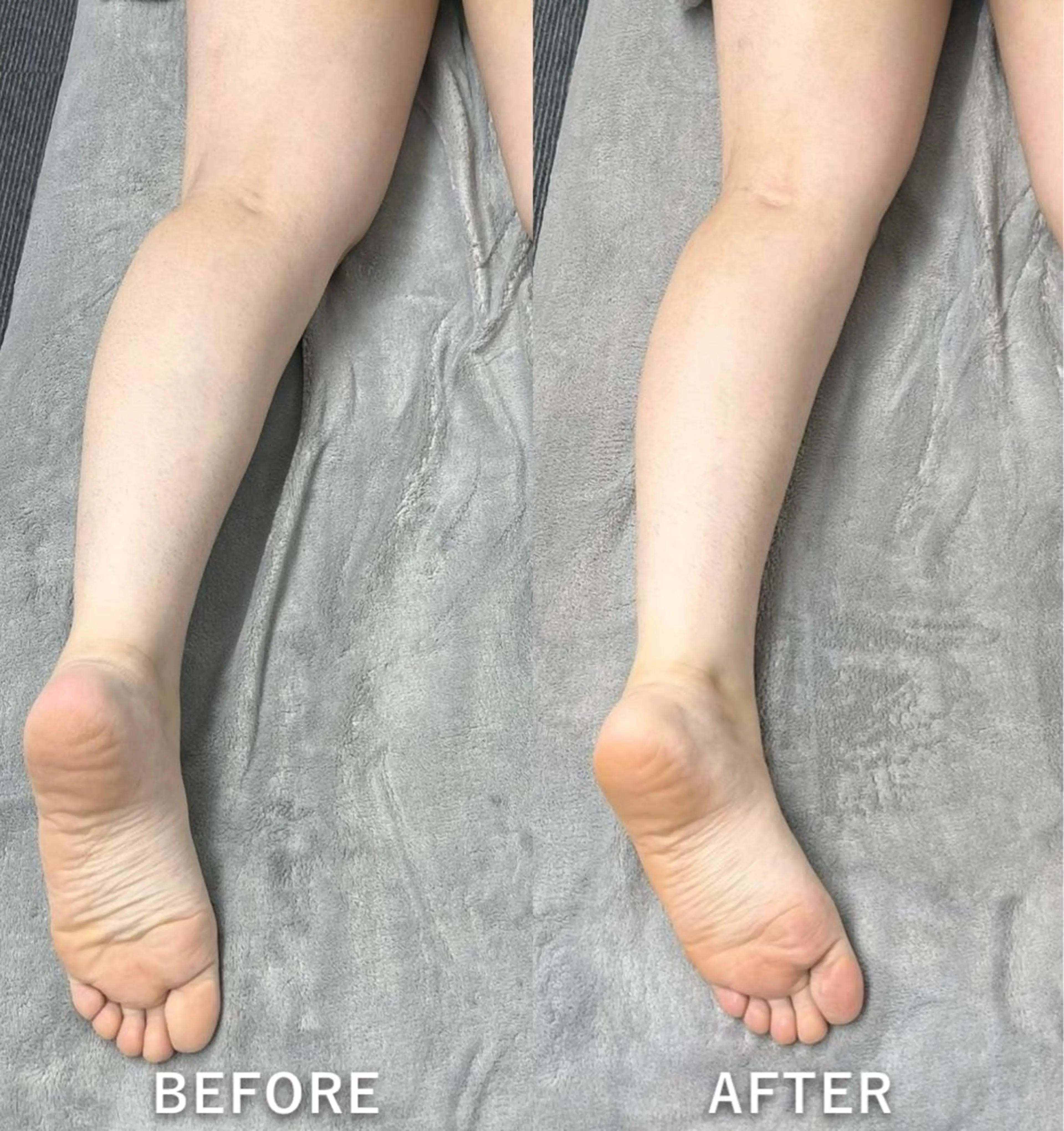 脂肪冷却/美肌改善 COCOKARAのエステ・リラクイメージ