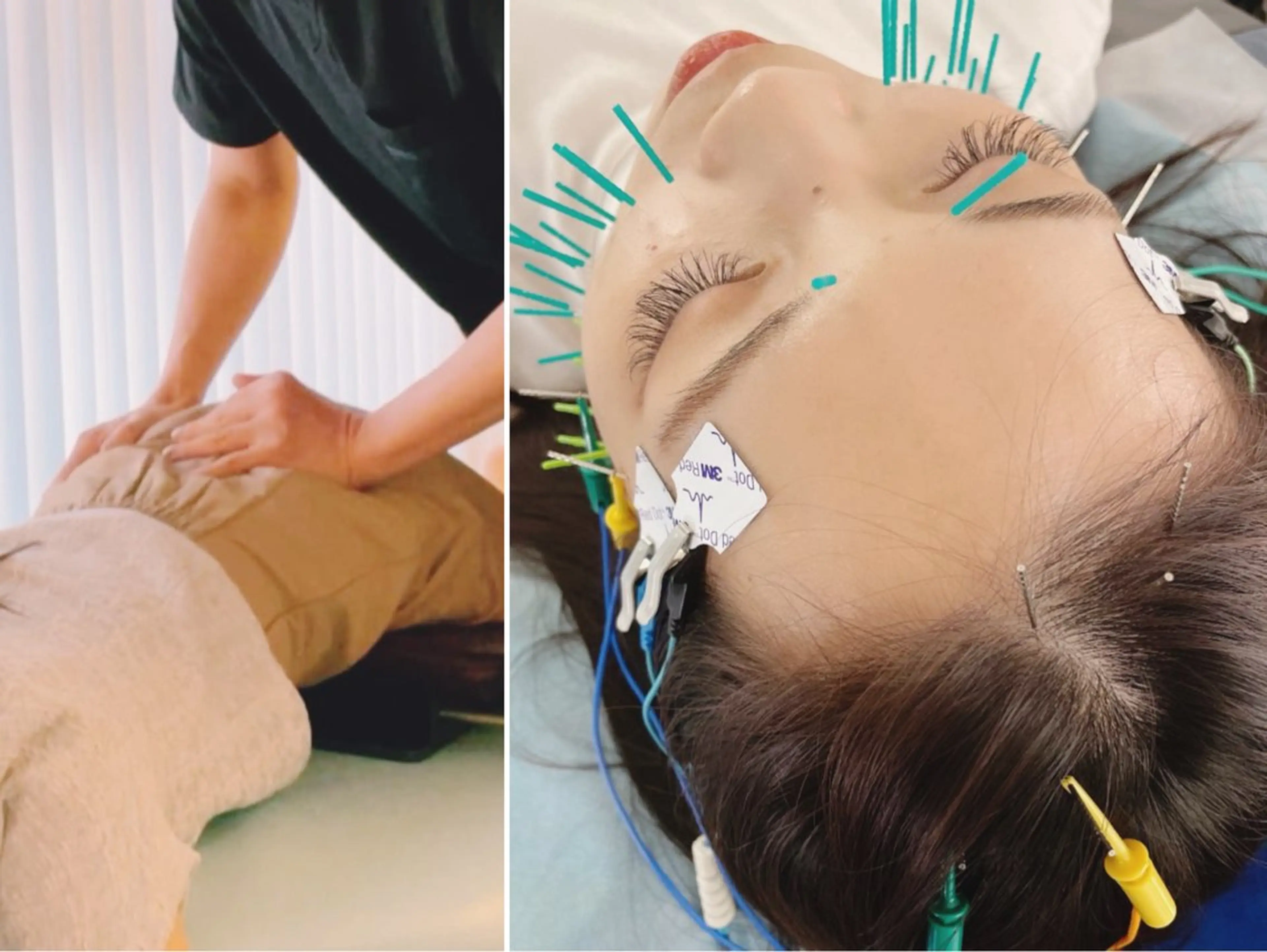 小顔美容鍼専門サロン 渋谷YZのエステ・リラクイメージ