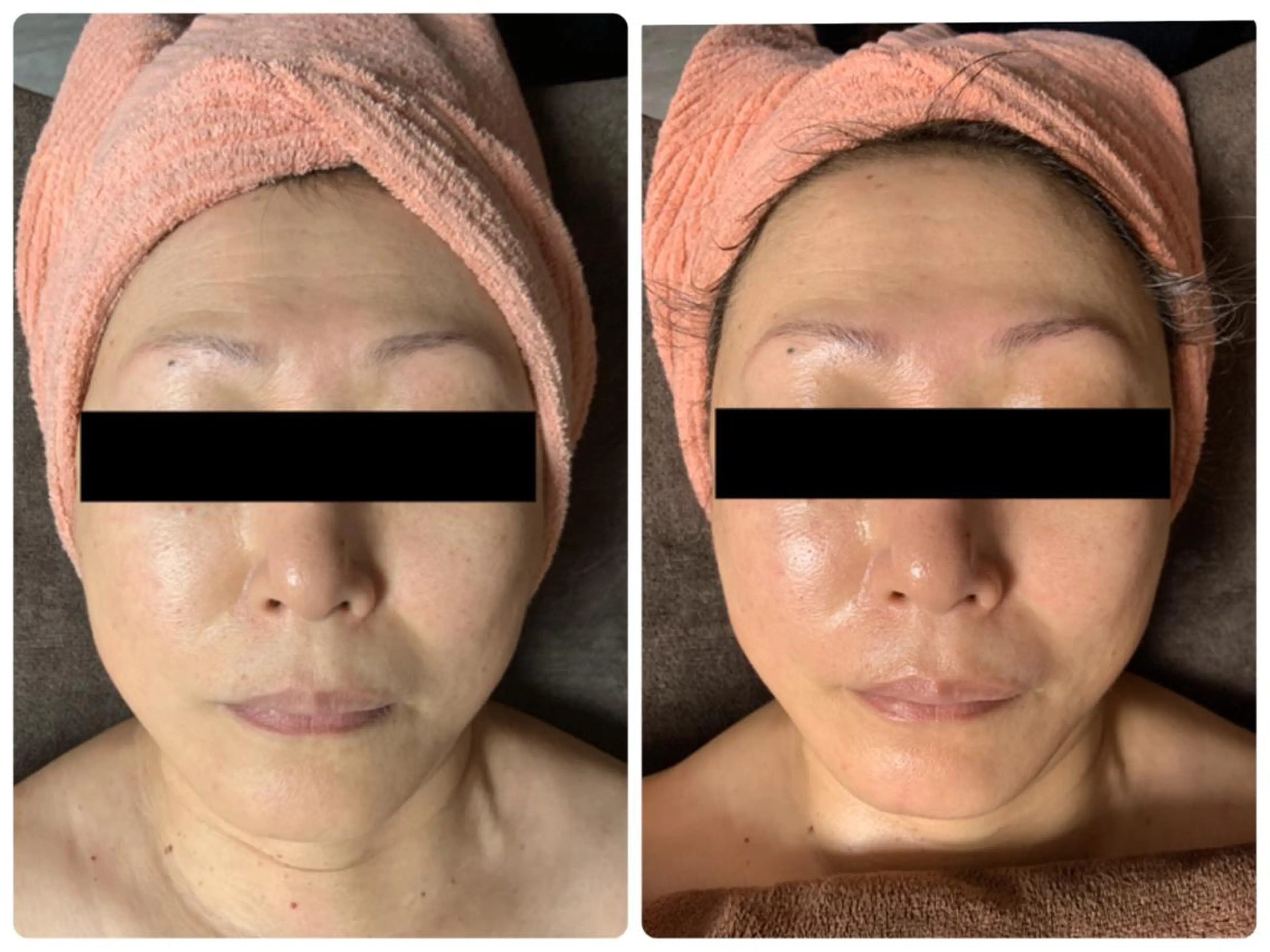 ドライヘッドスパ付き【小顔フェイシャル 顔〜デコルテ 60分】の写真