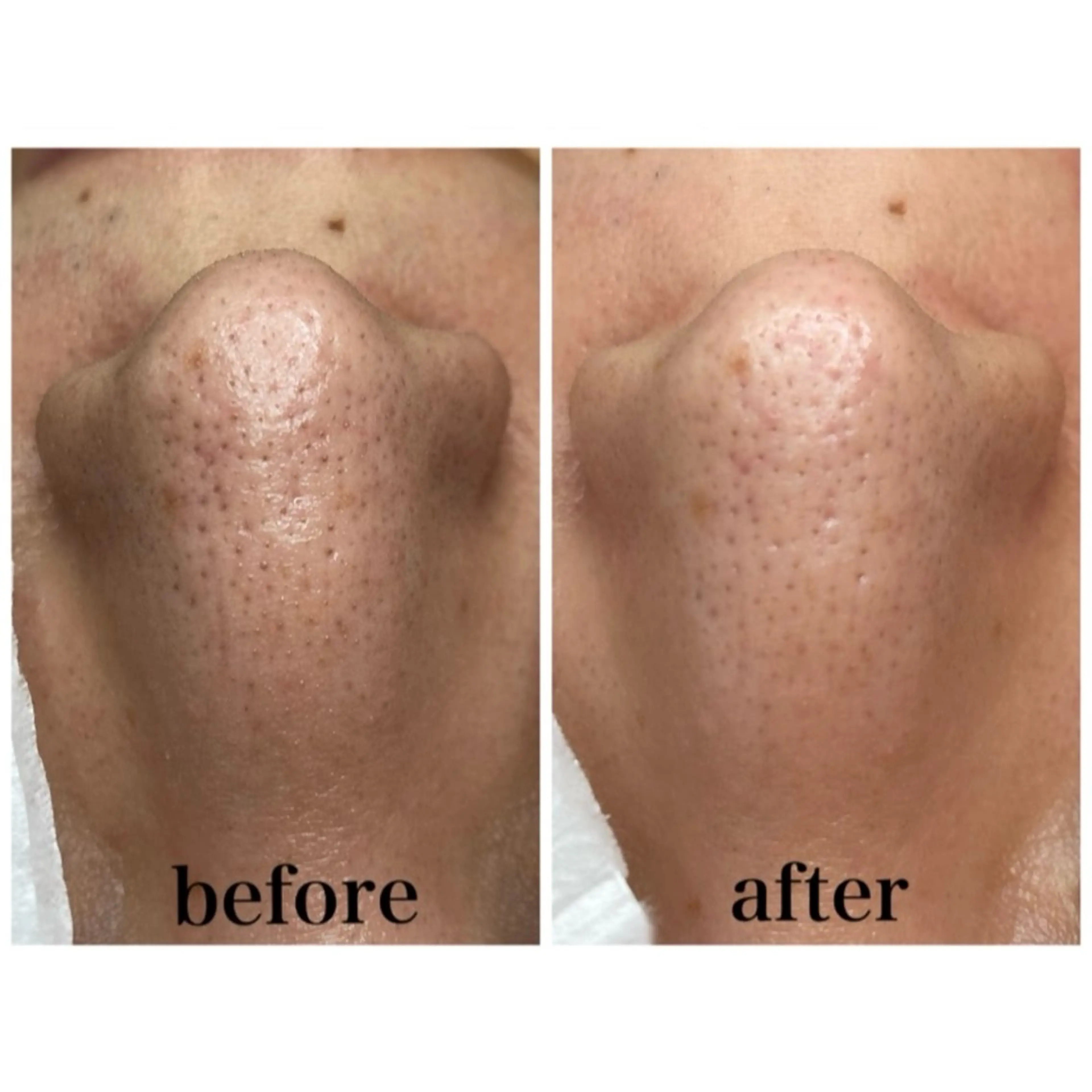 韓国肌管理 【毛穴専科】のエステ・リラクイメージ