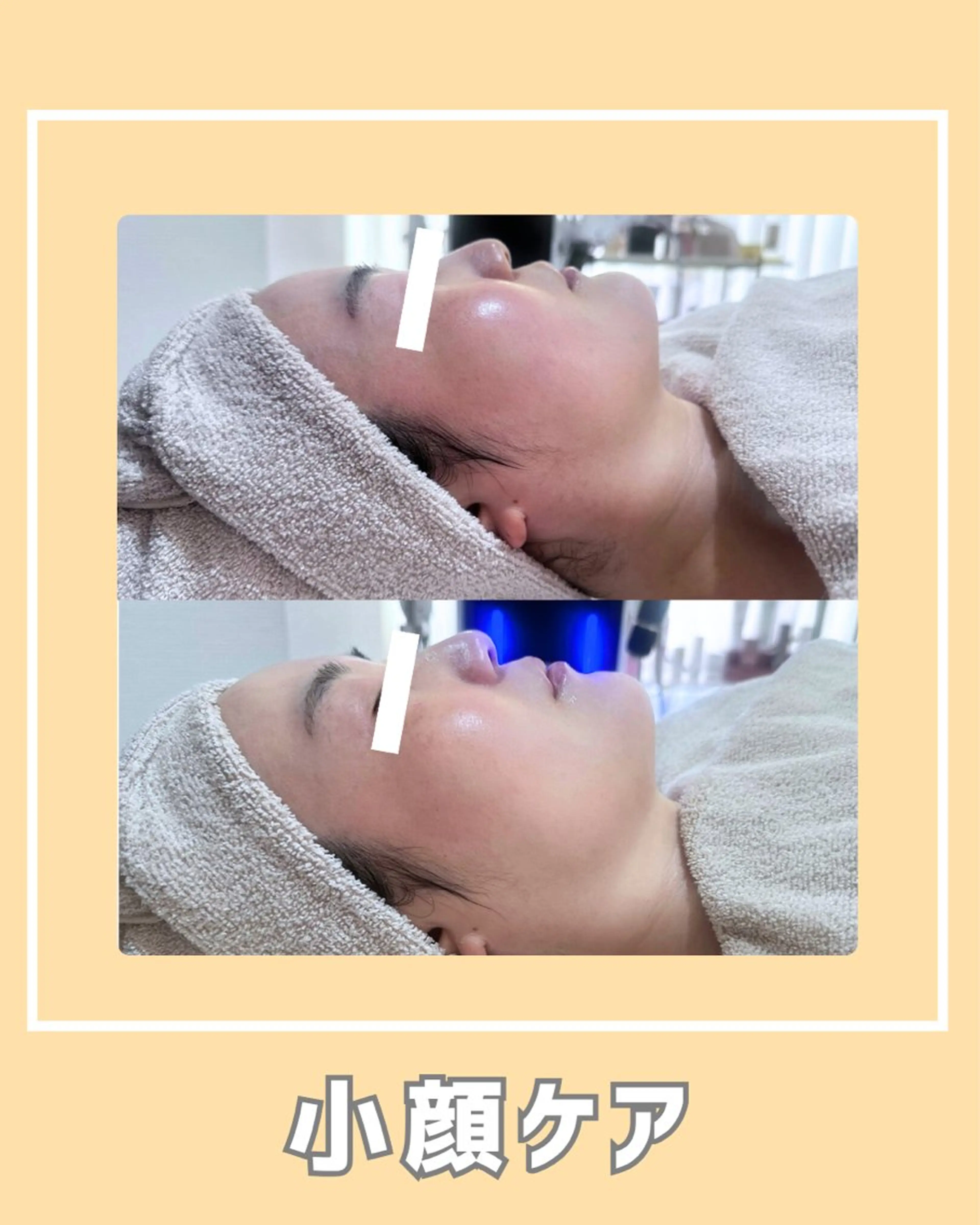 その他 |ピーリング・毛穴| soina神楽坂のエステ・リラクイメージ