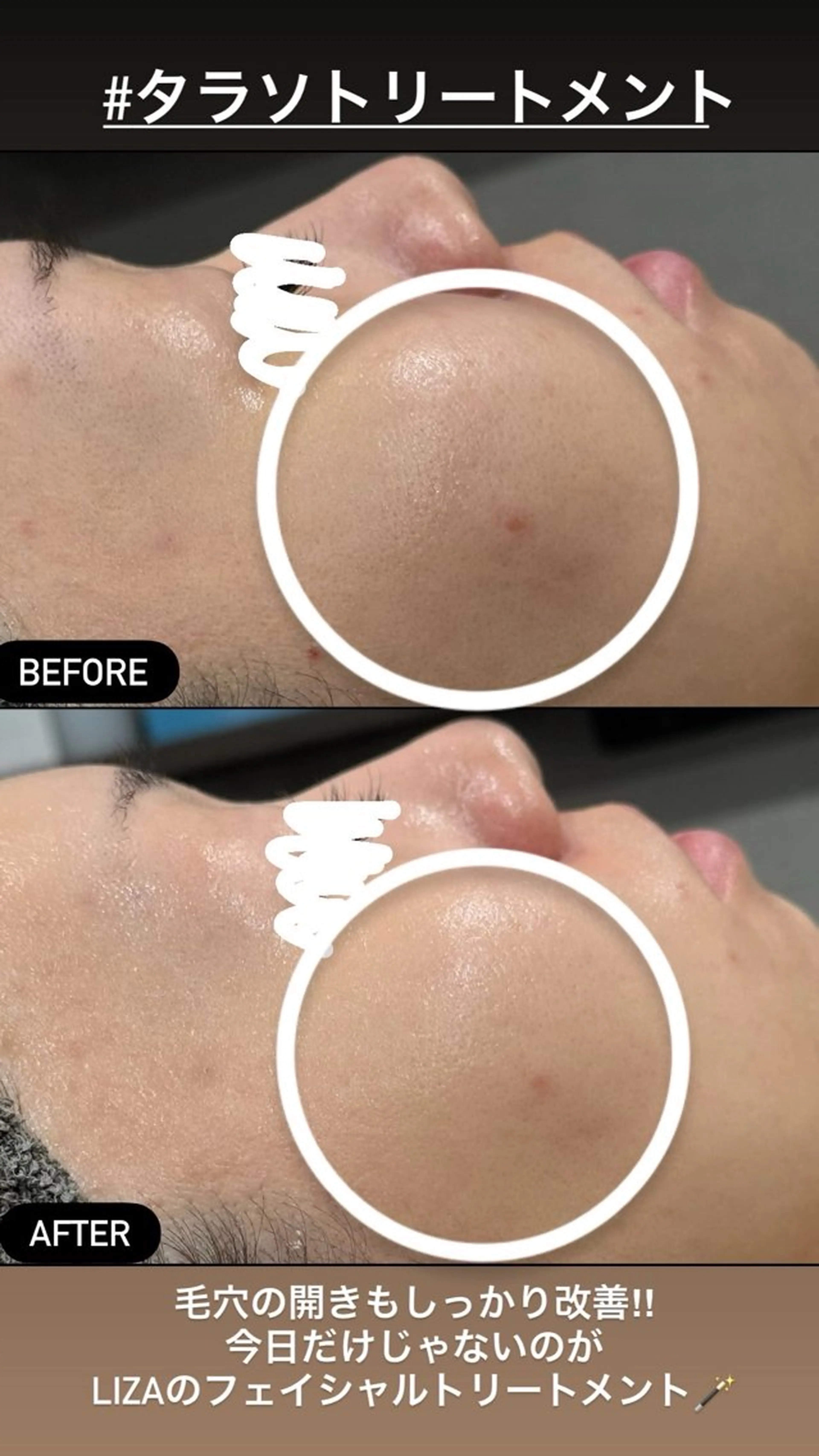 エステ LiZA エステティックサロンのエステ・リラクイメージ