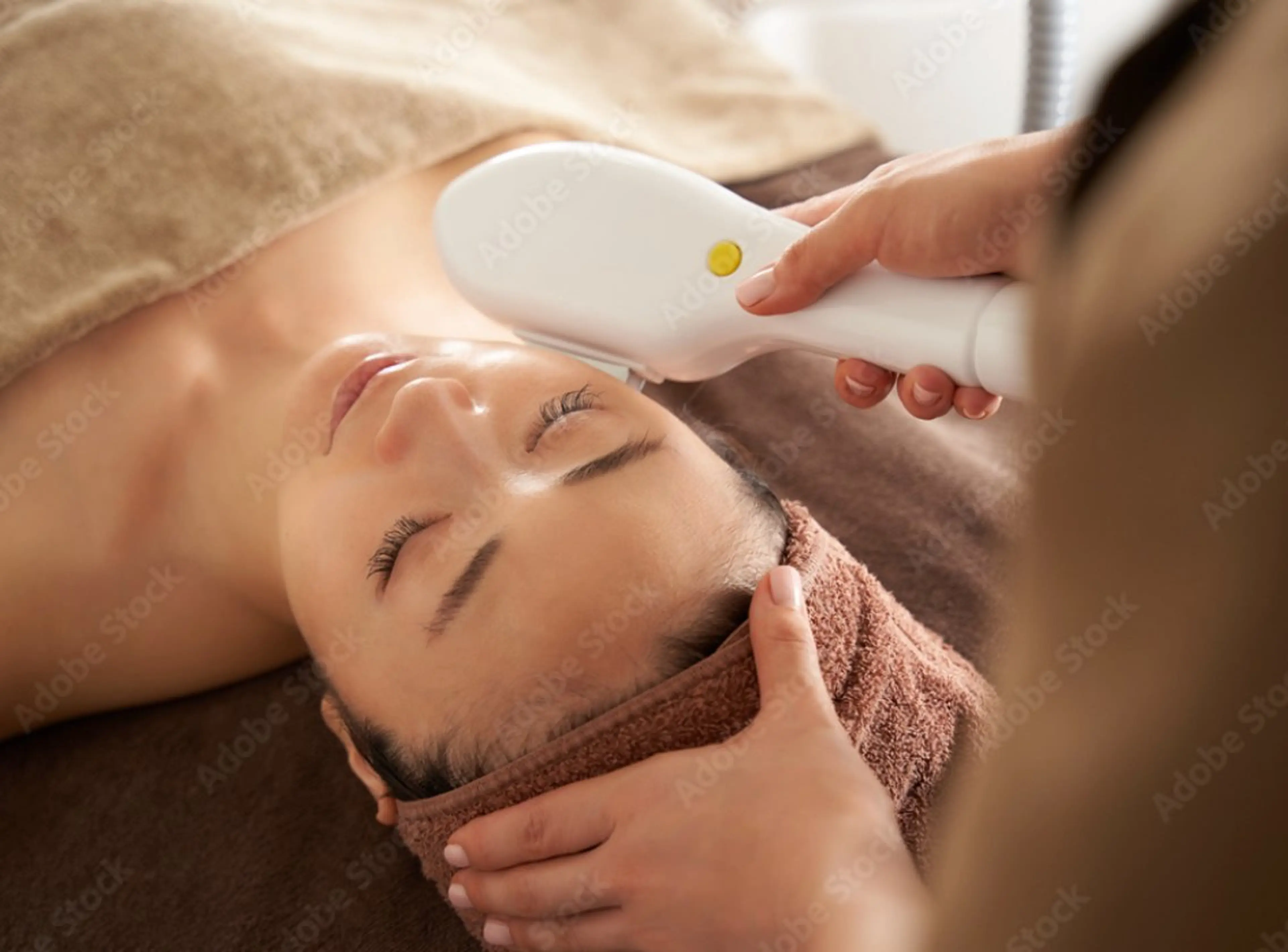 IPL 光フェイシャルの写真