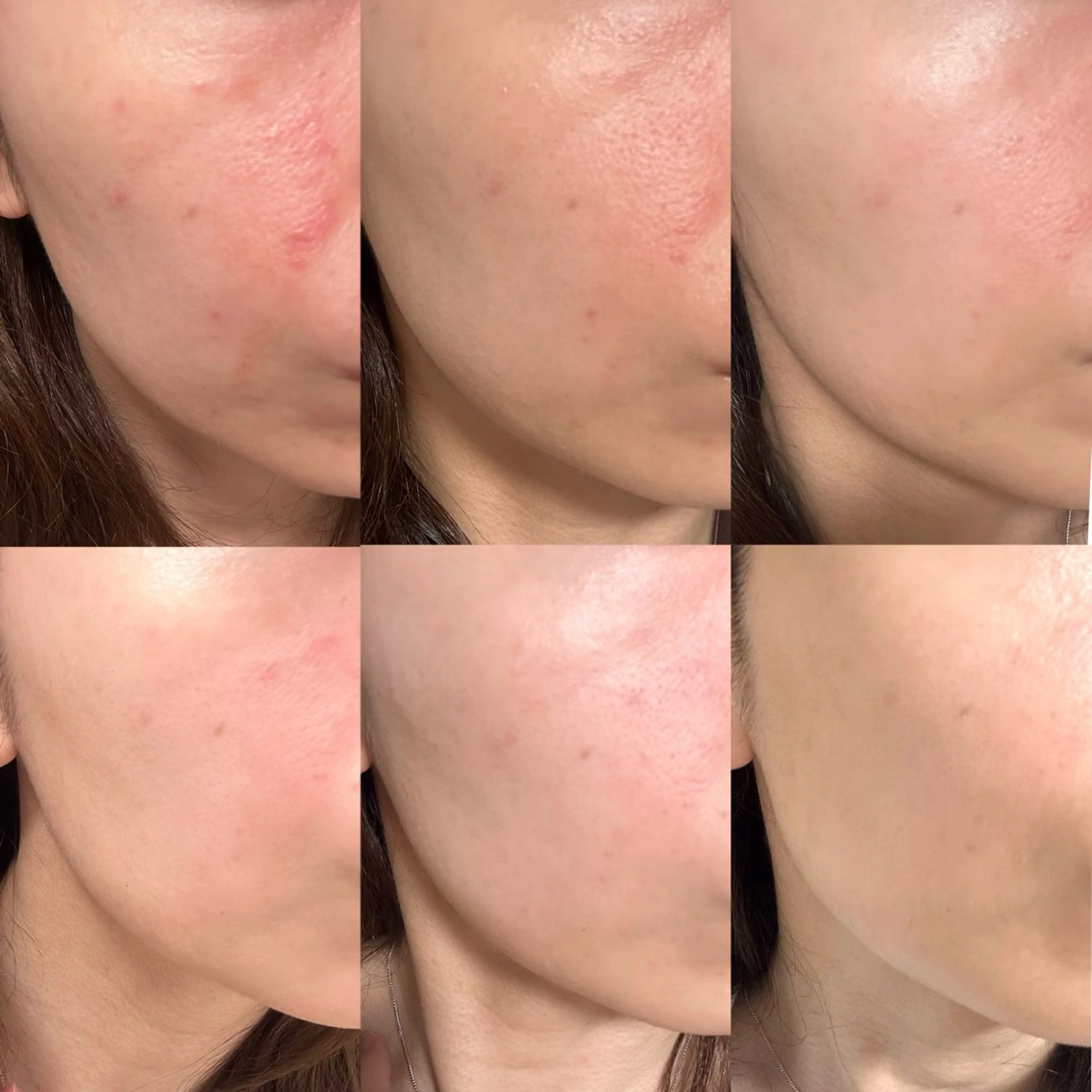 エステ Charis エステ&ネイルのエステ・リラクイメージ