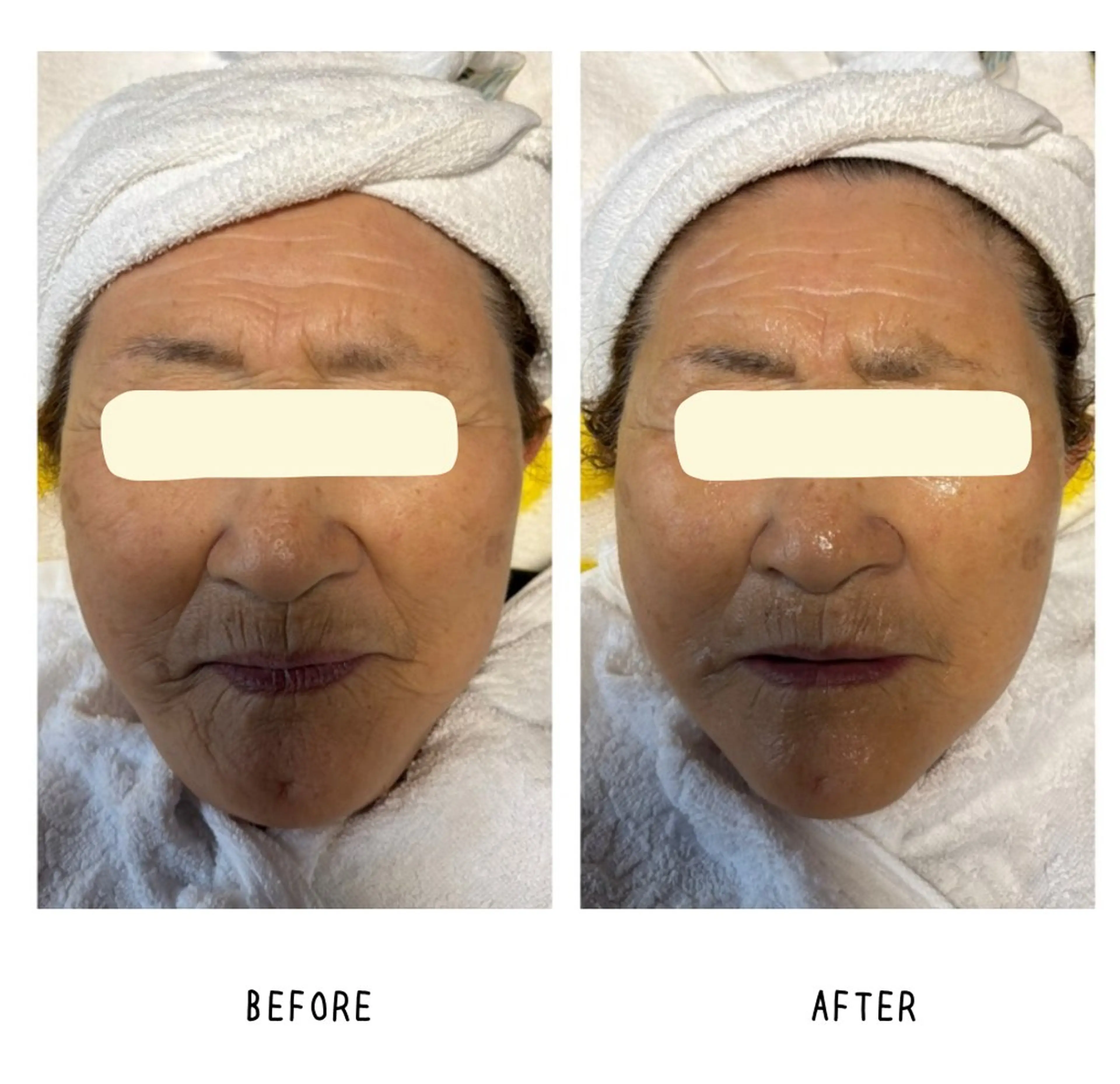 grow所属・Yoshino Erinaのエステ・リラクイメージ