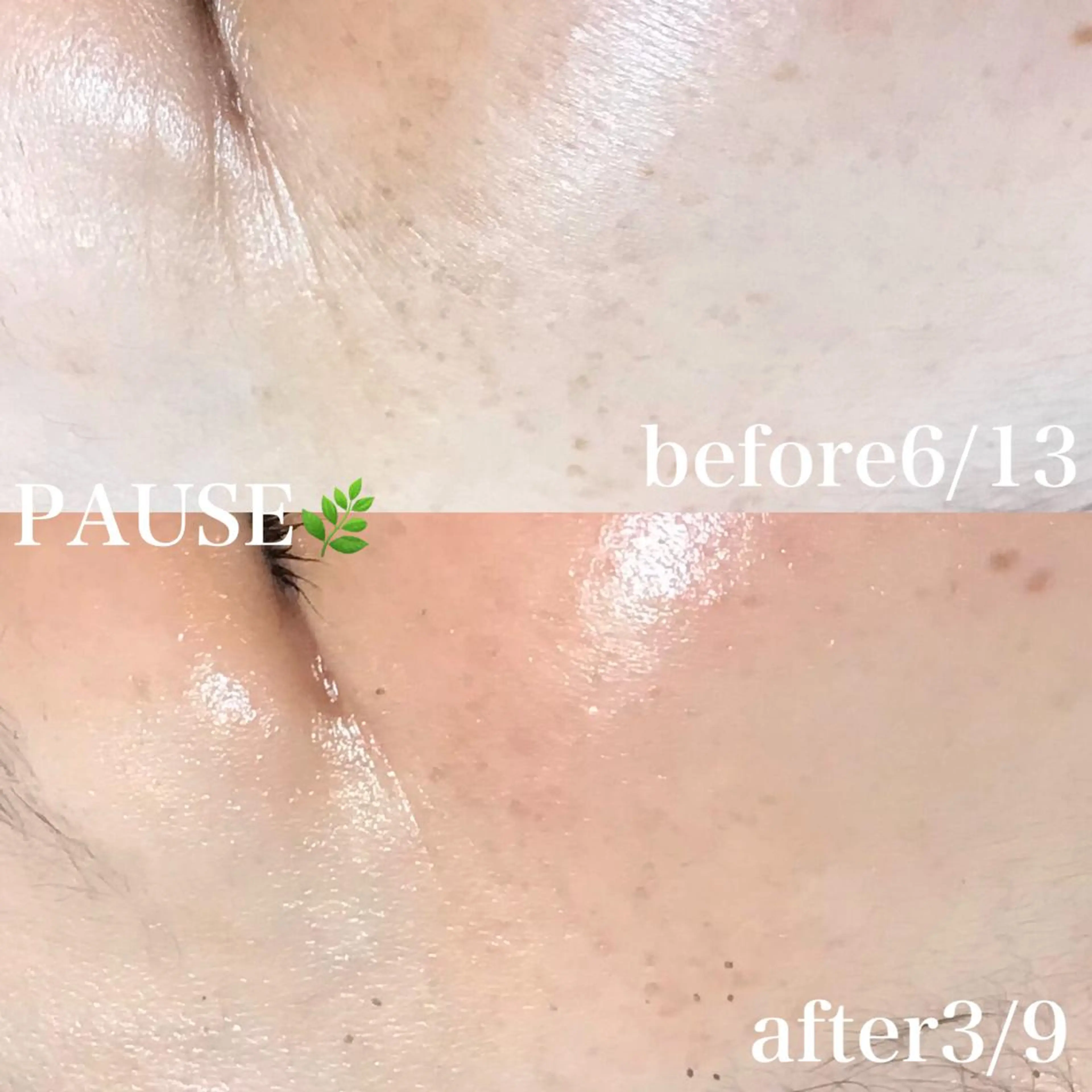 エステ 浜野 恵美のエステ・リラクイメージ