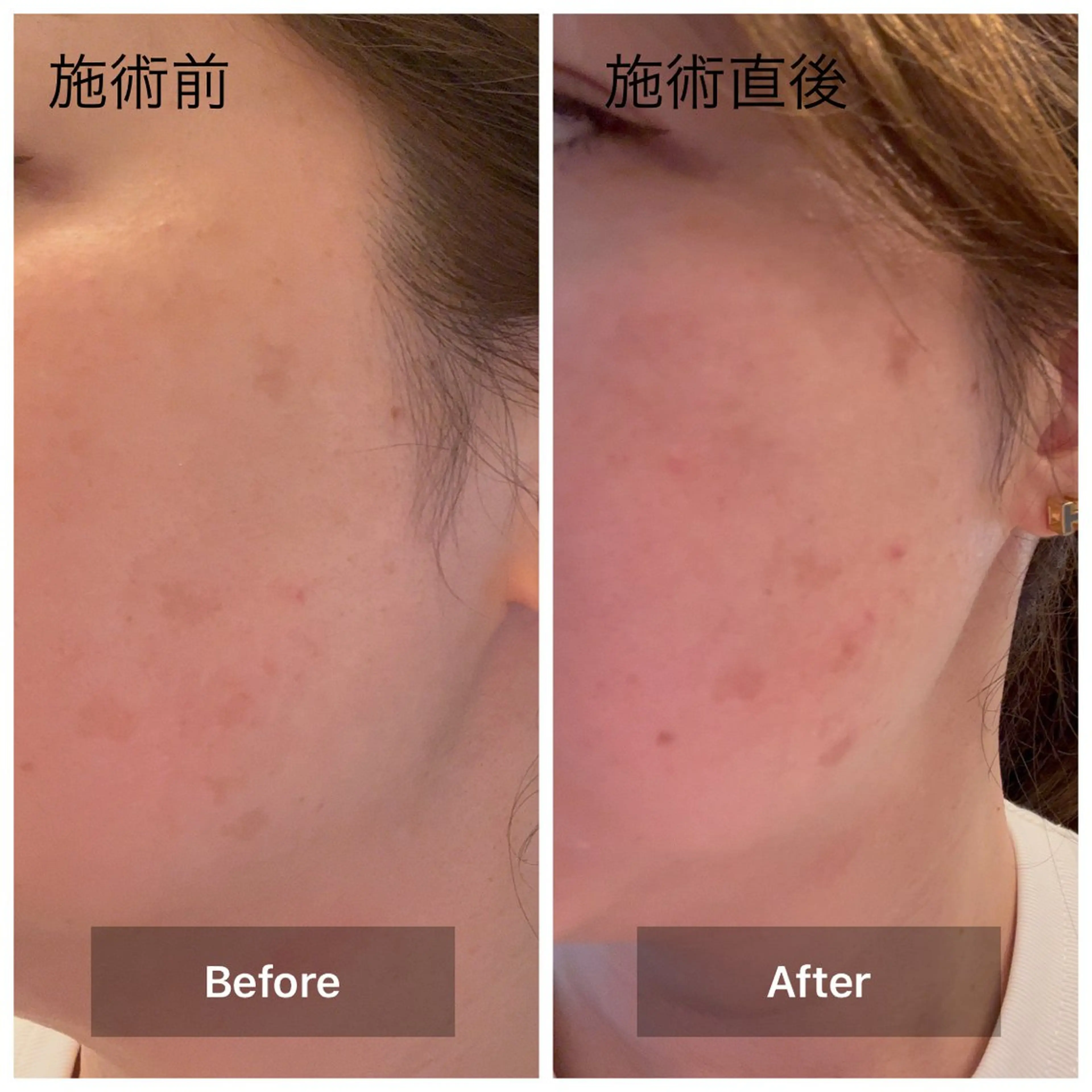 エステ リラク 目元・まつパ・美肌フ ェイシャル谷町四丁目のマツエク・マツパデザイン