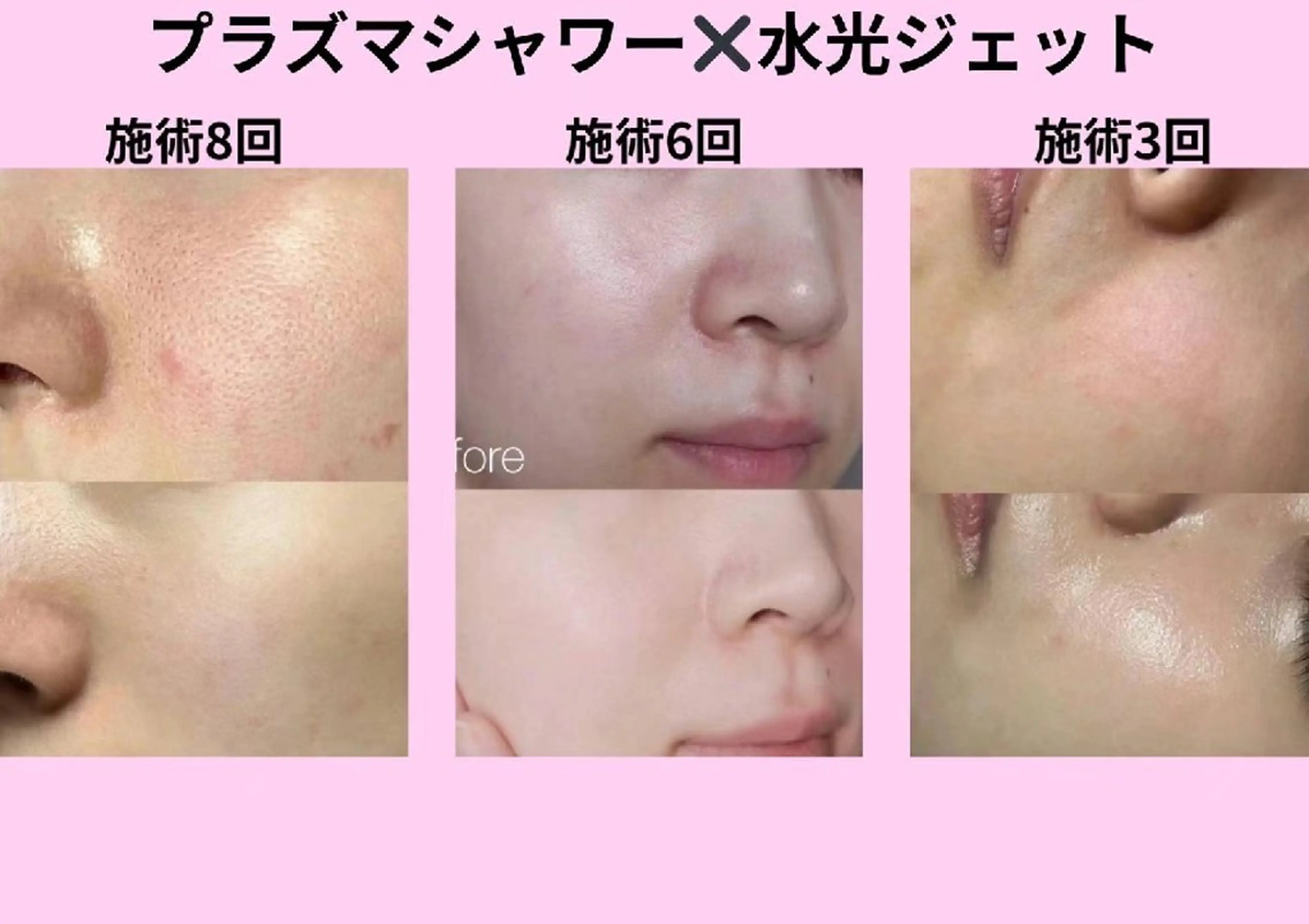 ネイル ブライダルネイル aliaハイフ&水光ジェットサロン所属・aliaハーブ水光店 エステティシャン募集のエステ・リラクイメージ