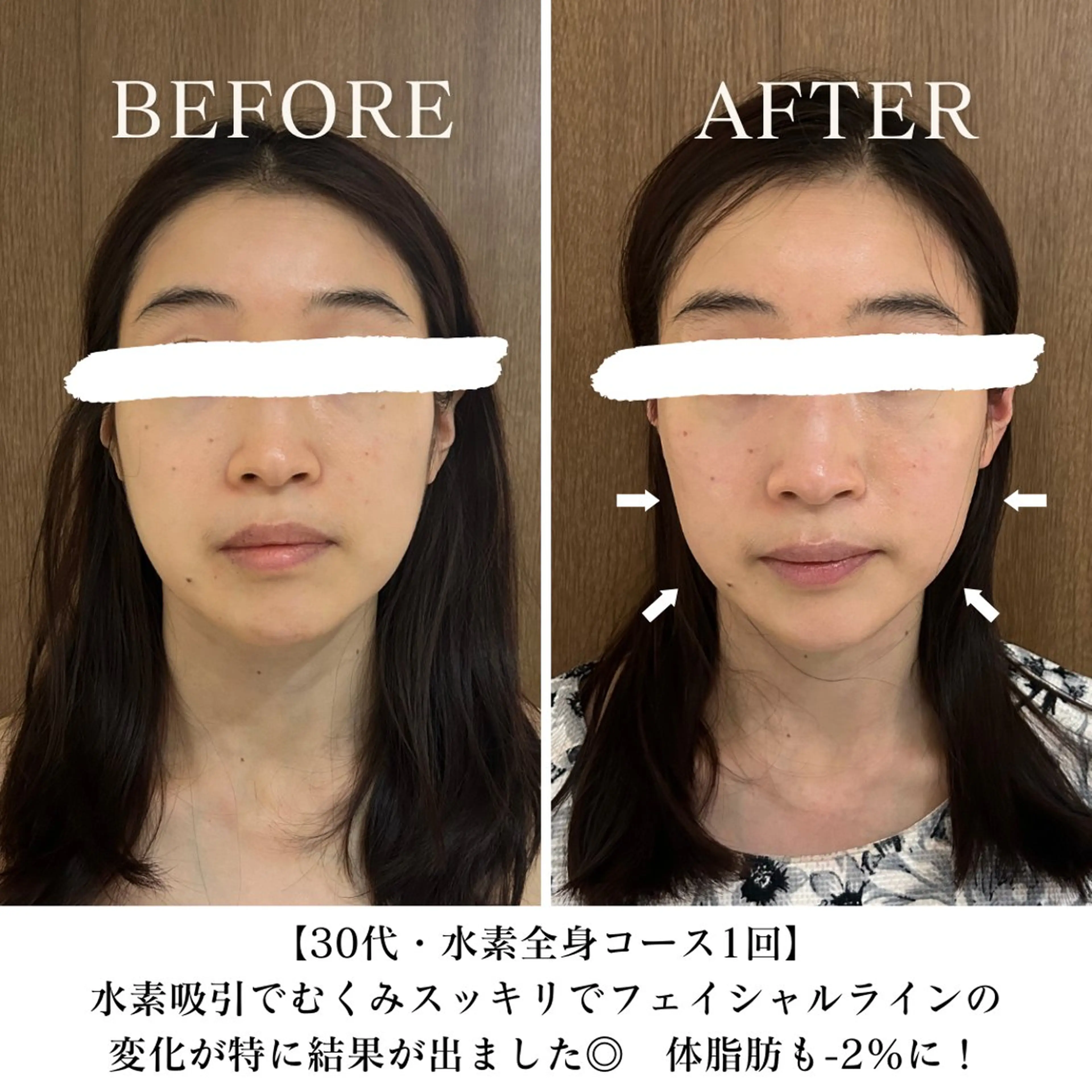 【平日16時まで限定】1番人気コース！水素まみれコース♪100分の写真