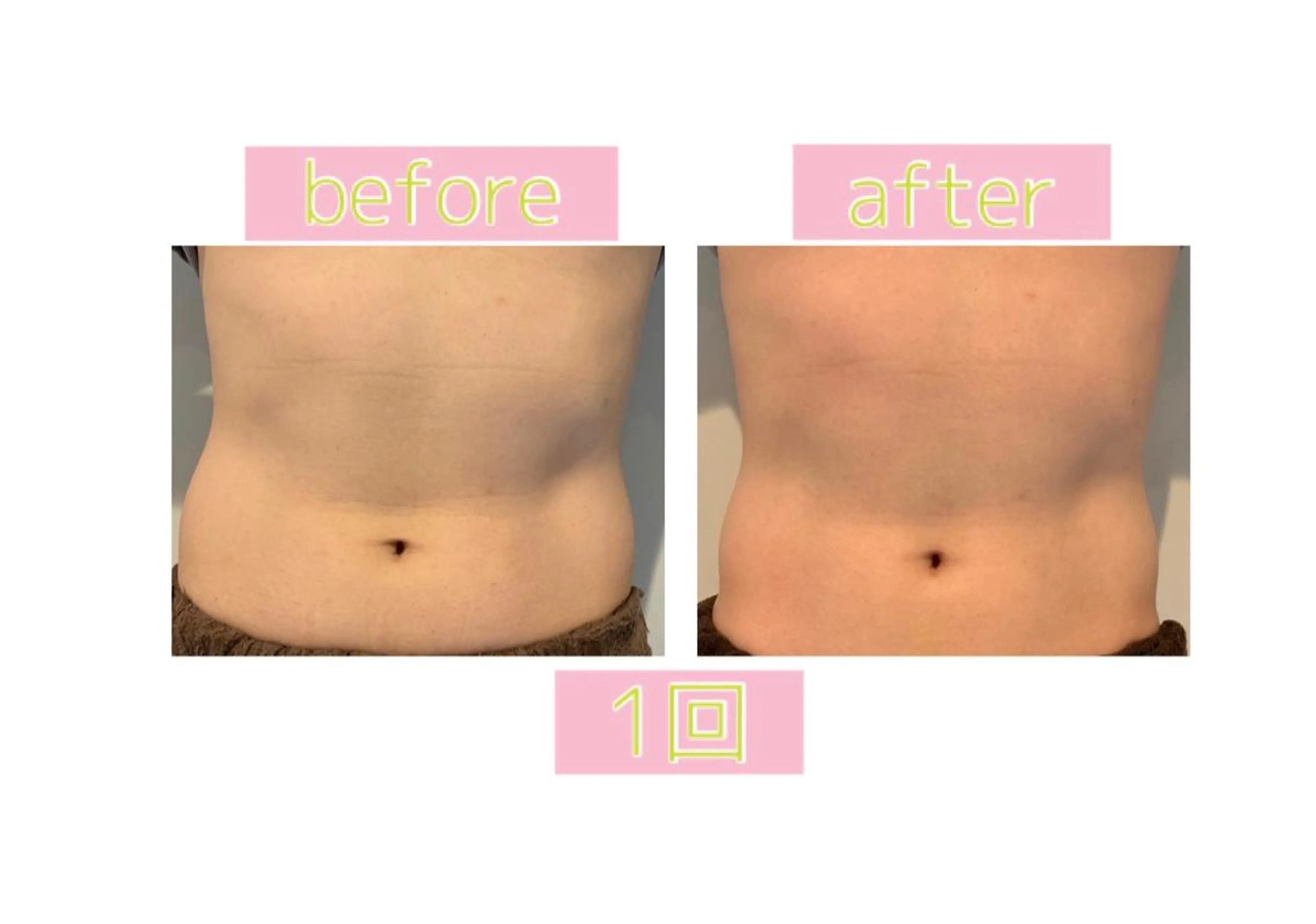 メンズ エステ 癒し腸もみサロン シャユーム　ゆきなのエステ・リラクイメージ