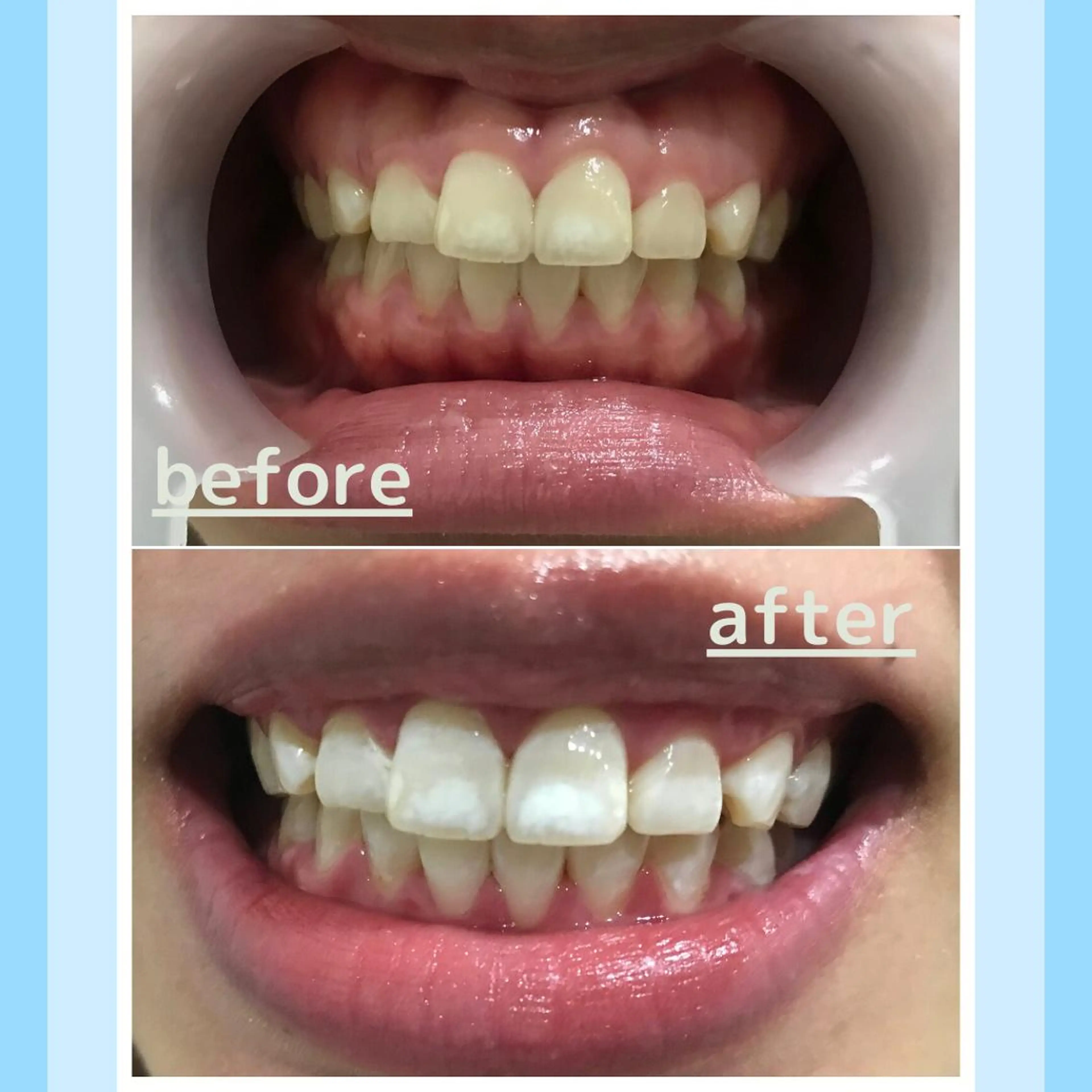 メンズ 学生（メンズ向け） お手軽ホワイトニングsalon mina所属・武元 奈津美のその他イメージ