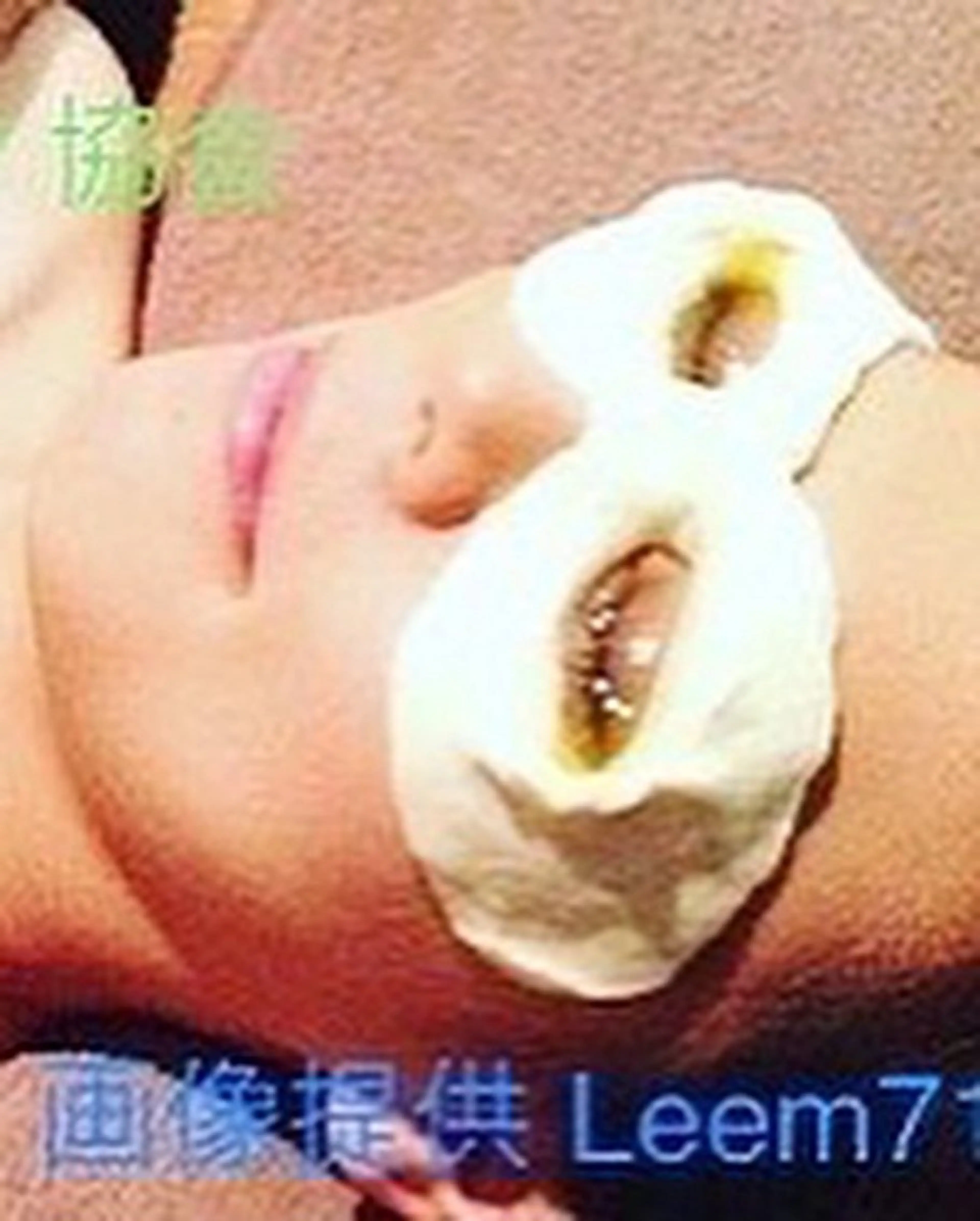 目の疲れに。話題のネトラバスティ体験の写真