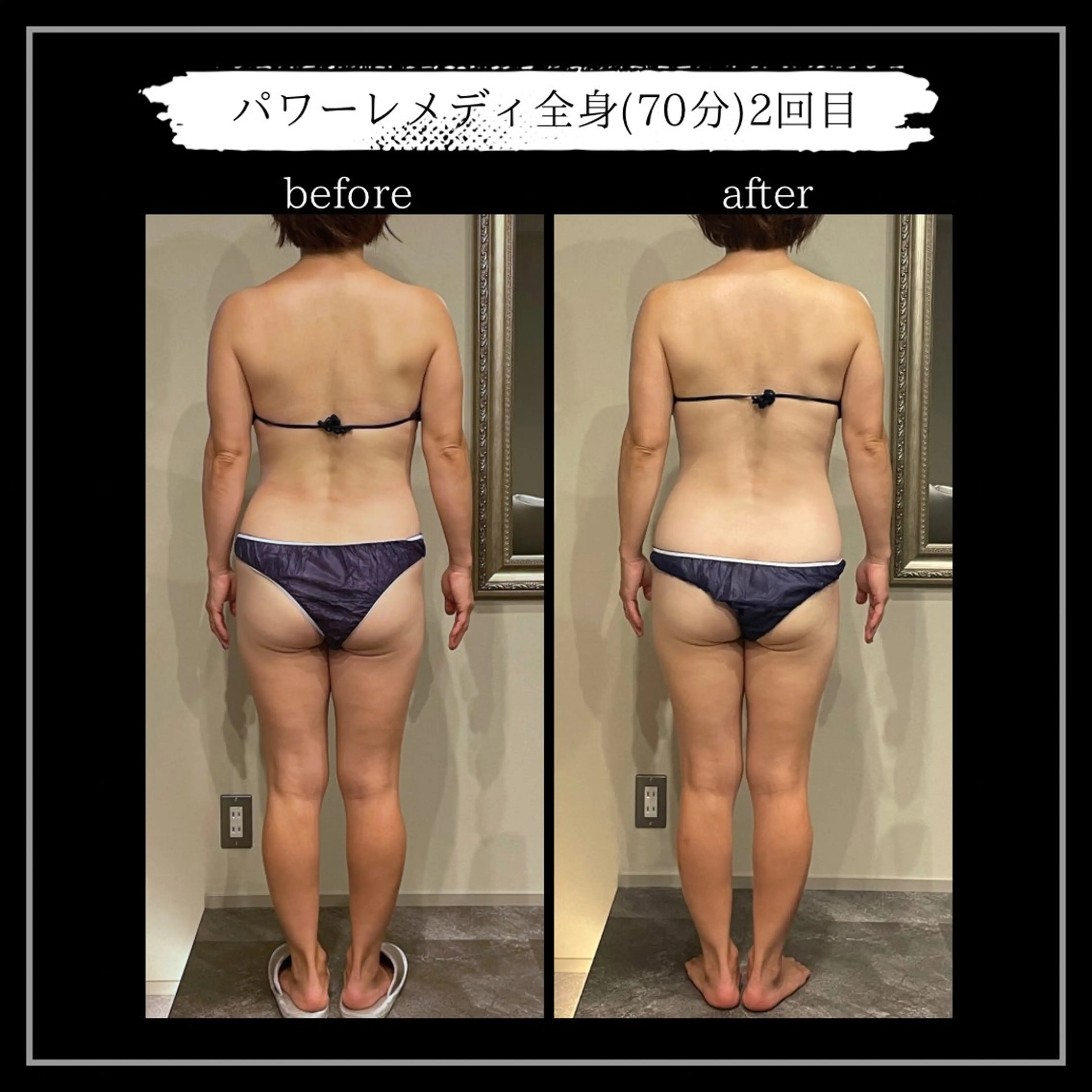 オフ:オン所属・オフ:オン 全身筋膜マッサージのエステ・リラクイメージ