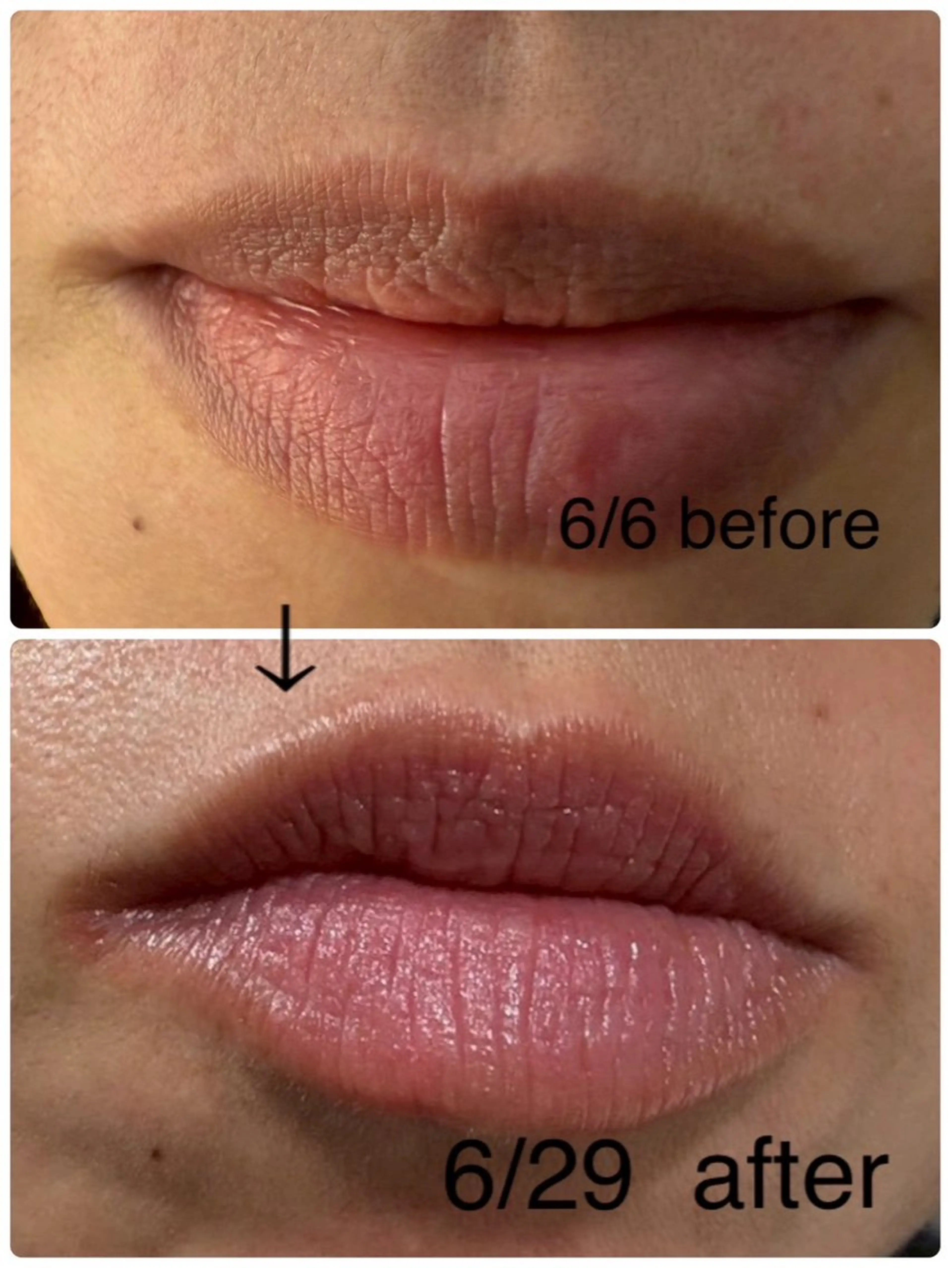 本気で痩せたい方へ 痩身専門サロンのその他イメージ