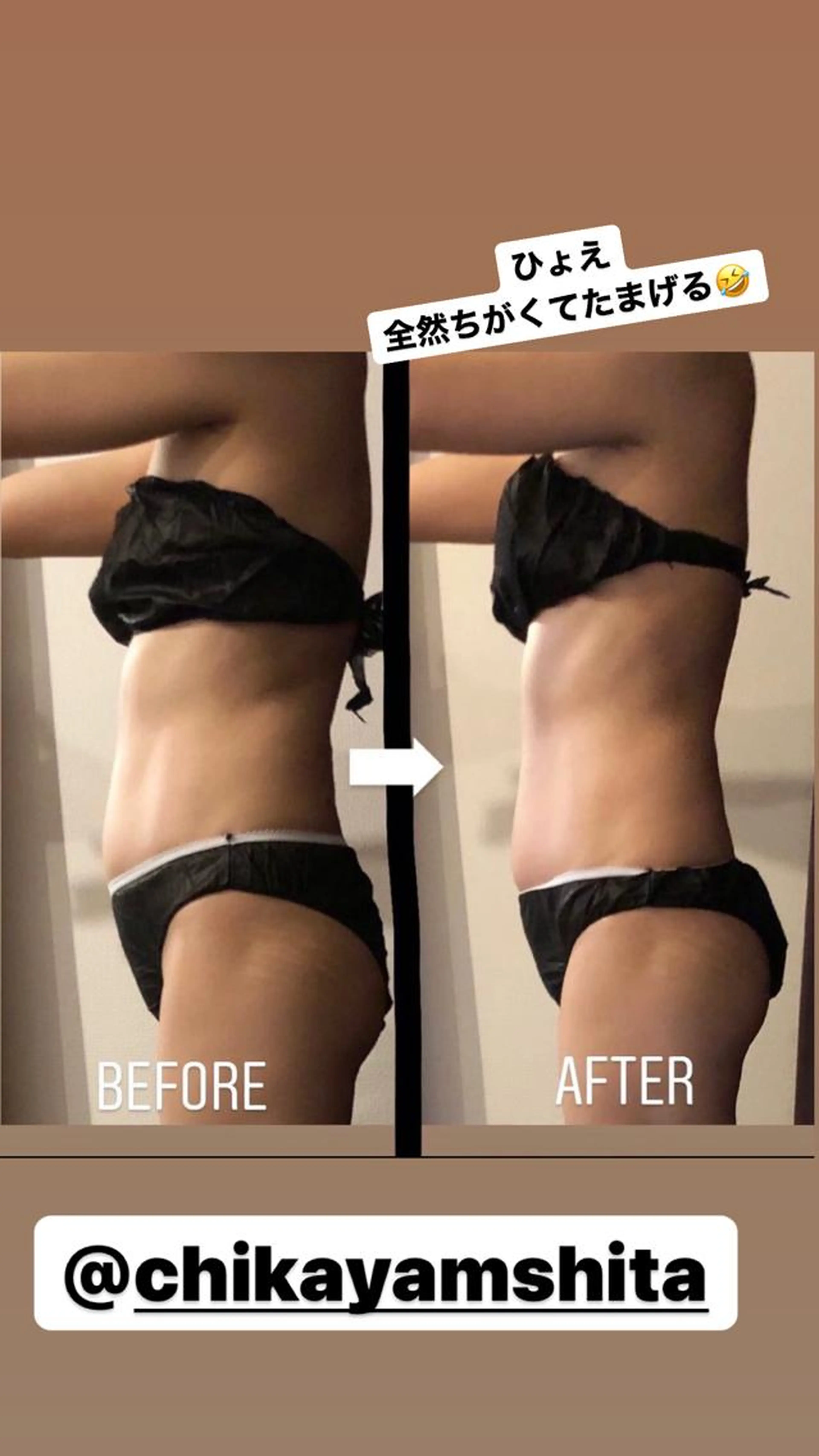 ハイパーナイフ全身骨格女優ボディコース✨の写真