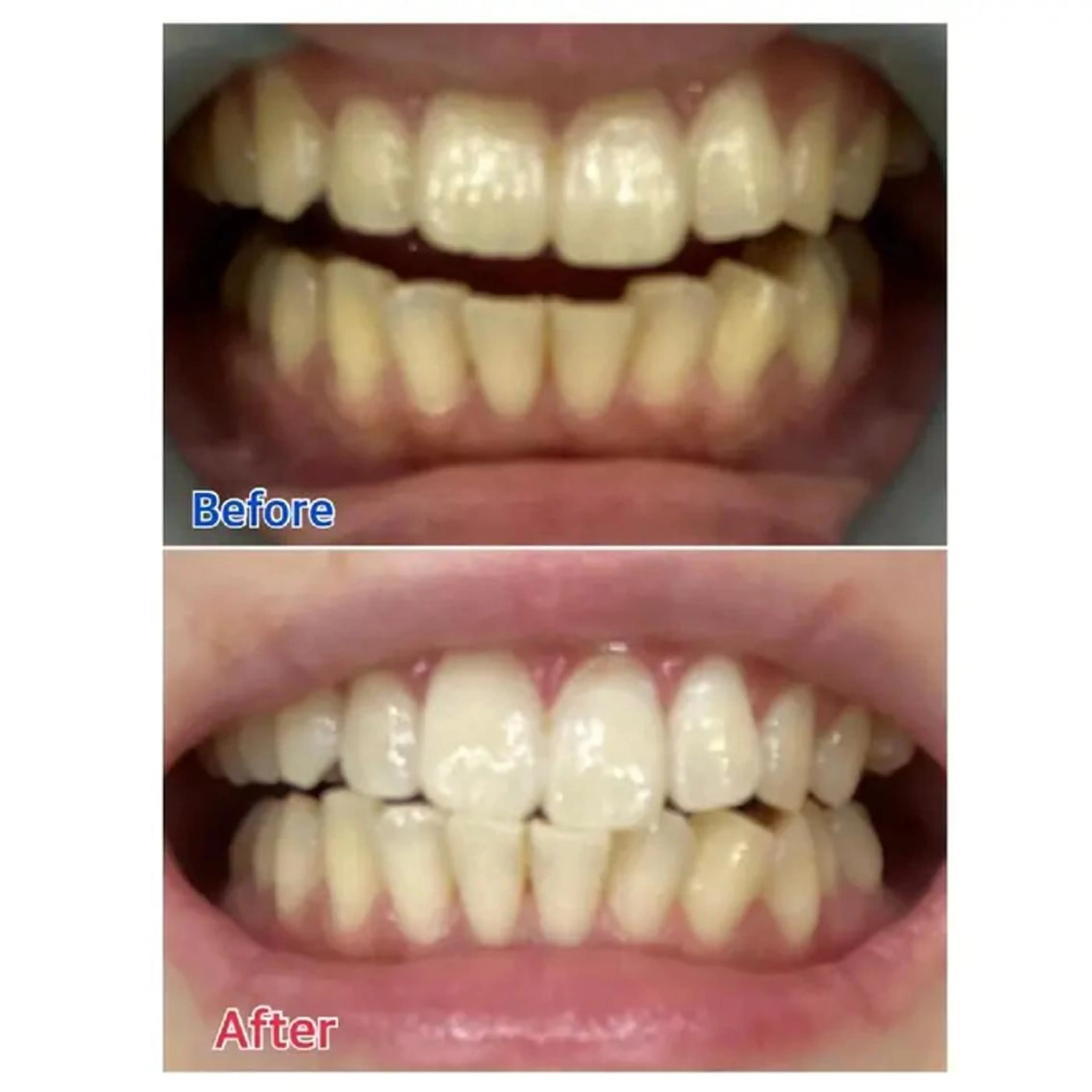 M渋谷店所属・Ｍ渋谷 ホワイトニングのその他イメージ