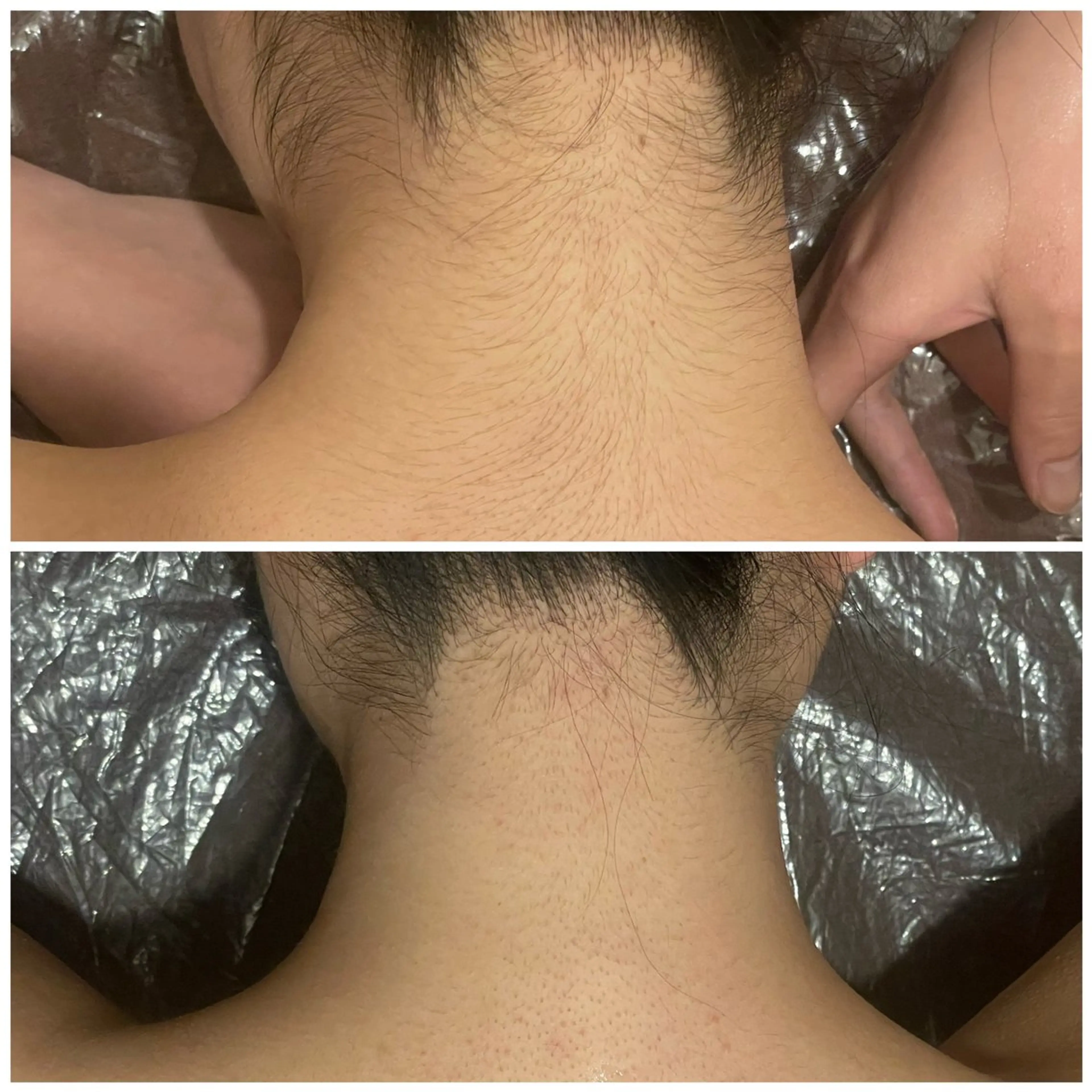 ミニモ限定⭐️ミニモ学割⭐️【脱毛】ワキ脱毛無料体験+脱毛カウンセリングクーポン✨の写真