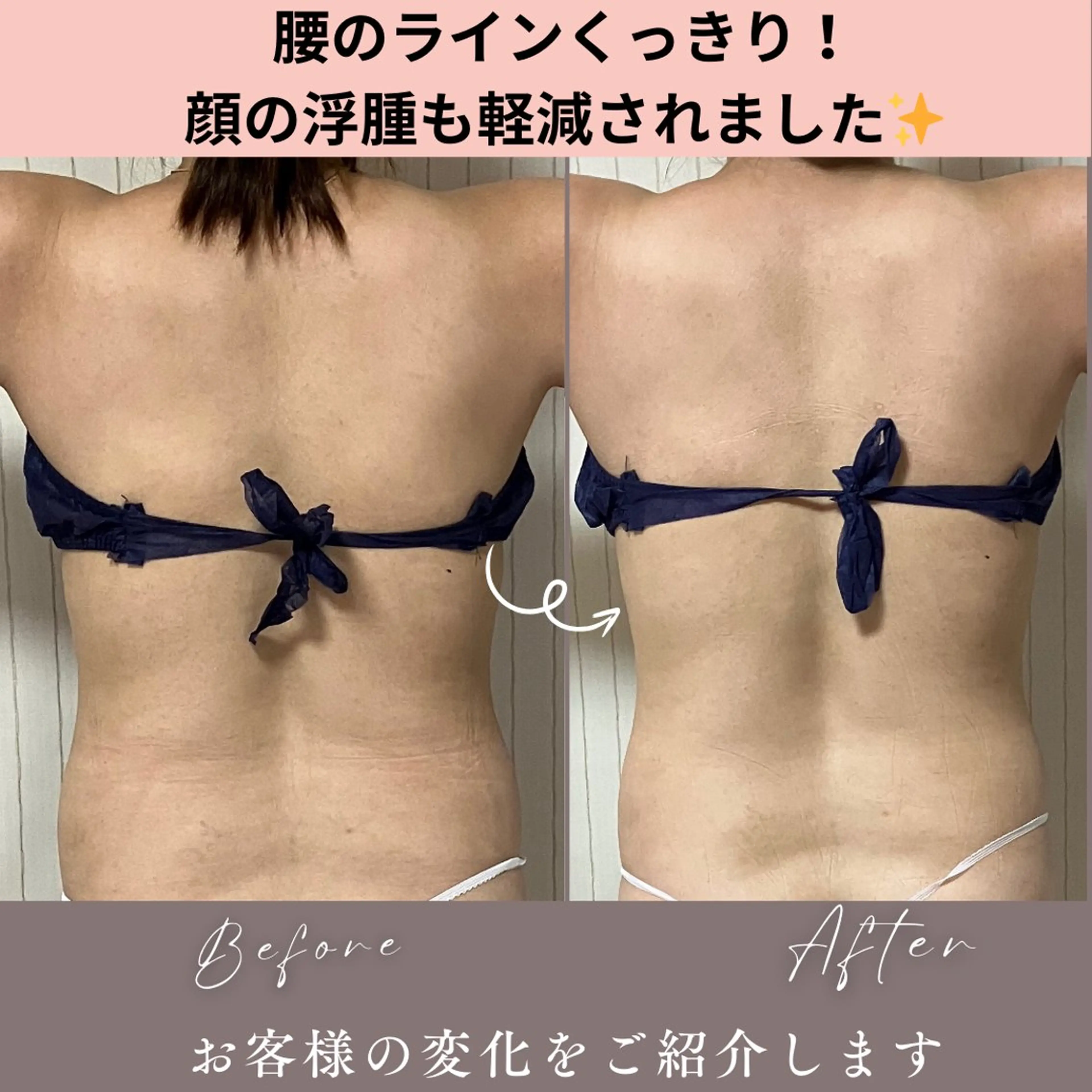 エステ akua... 【肌質管理専門】のその他イメージ