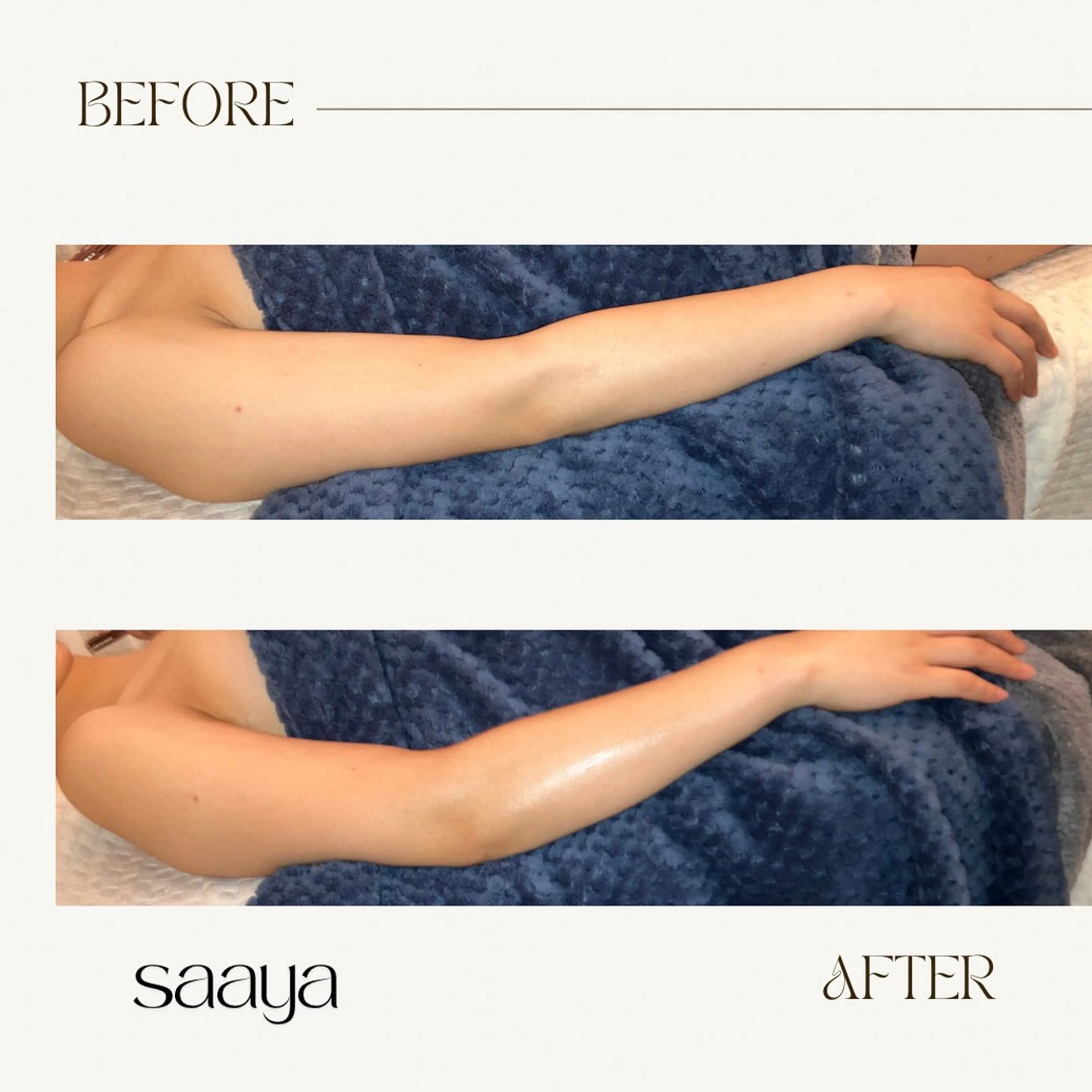 上半身痩身ケア　浮腫/たるみ/冷え性/肩こり/腰の痛みの写真