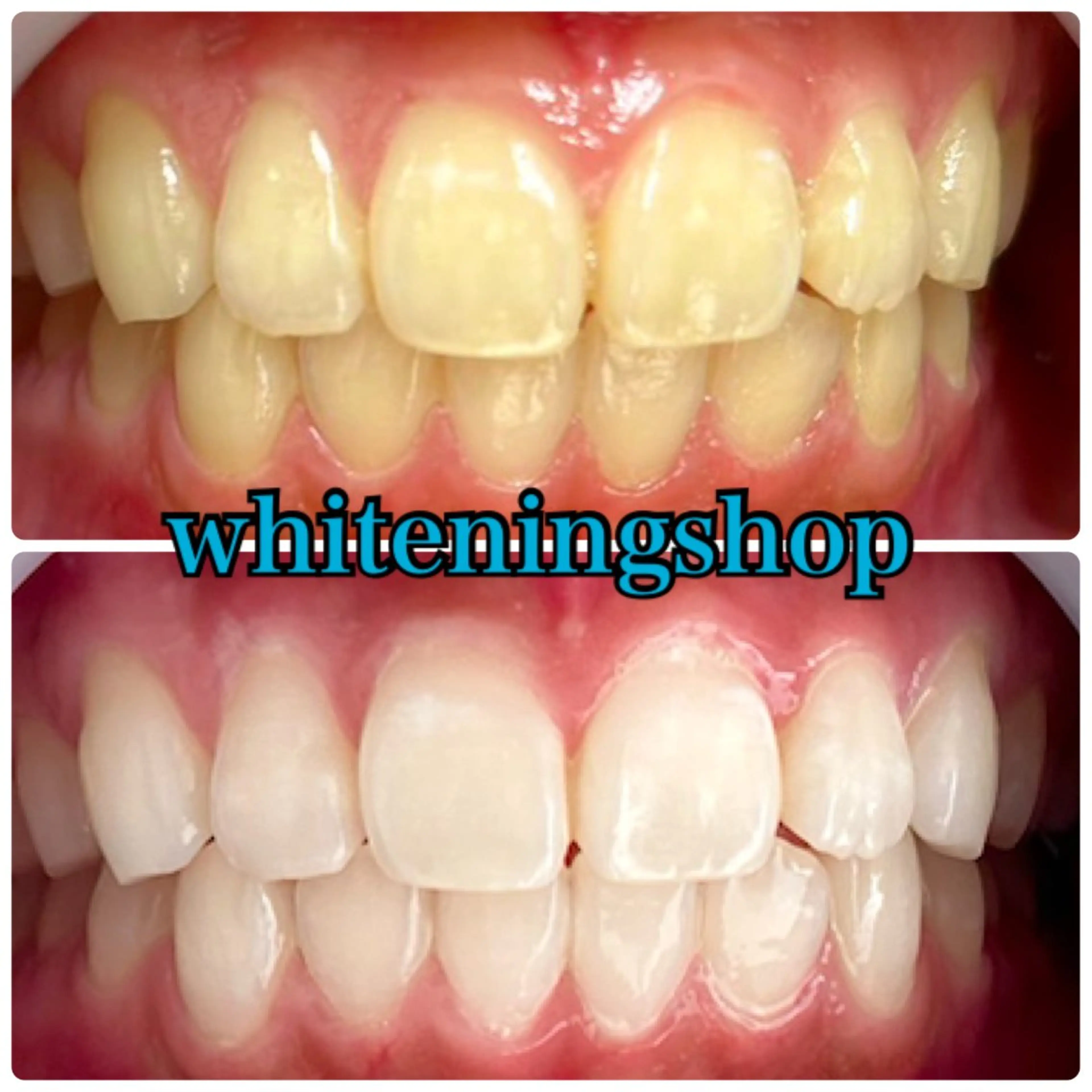 エステ リラク ホワイトニング ショップ吉祥寺店のエステ・リラクイメージ