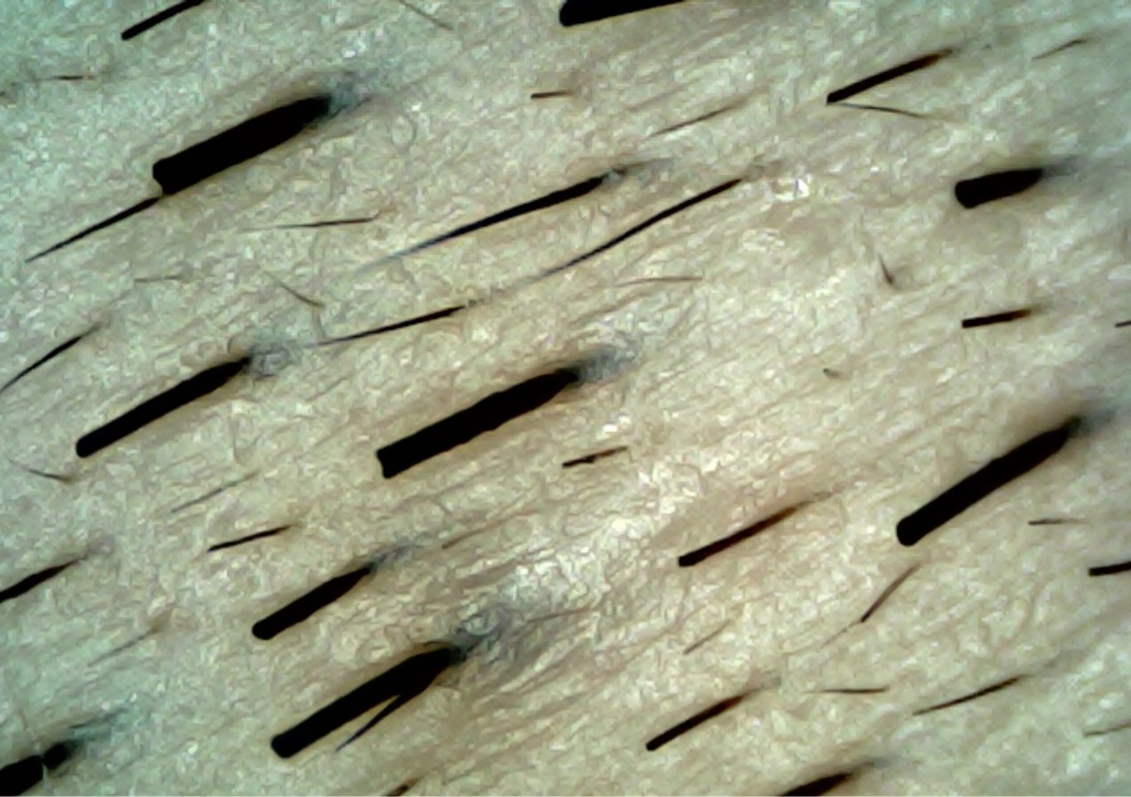 Hit. シュガーリング豊橋のエステ・リラクイメージ