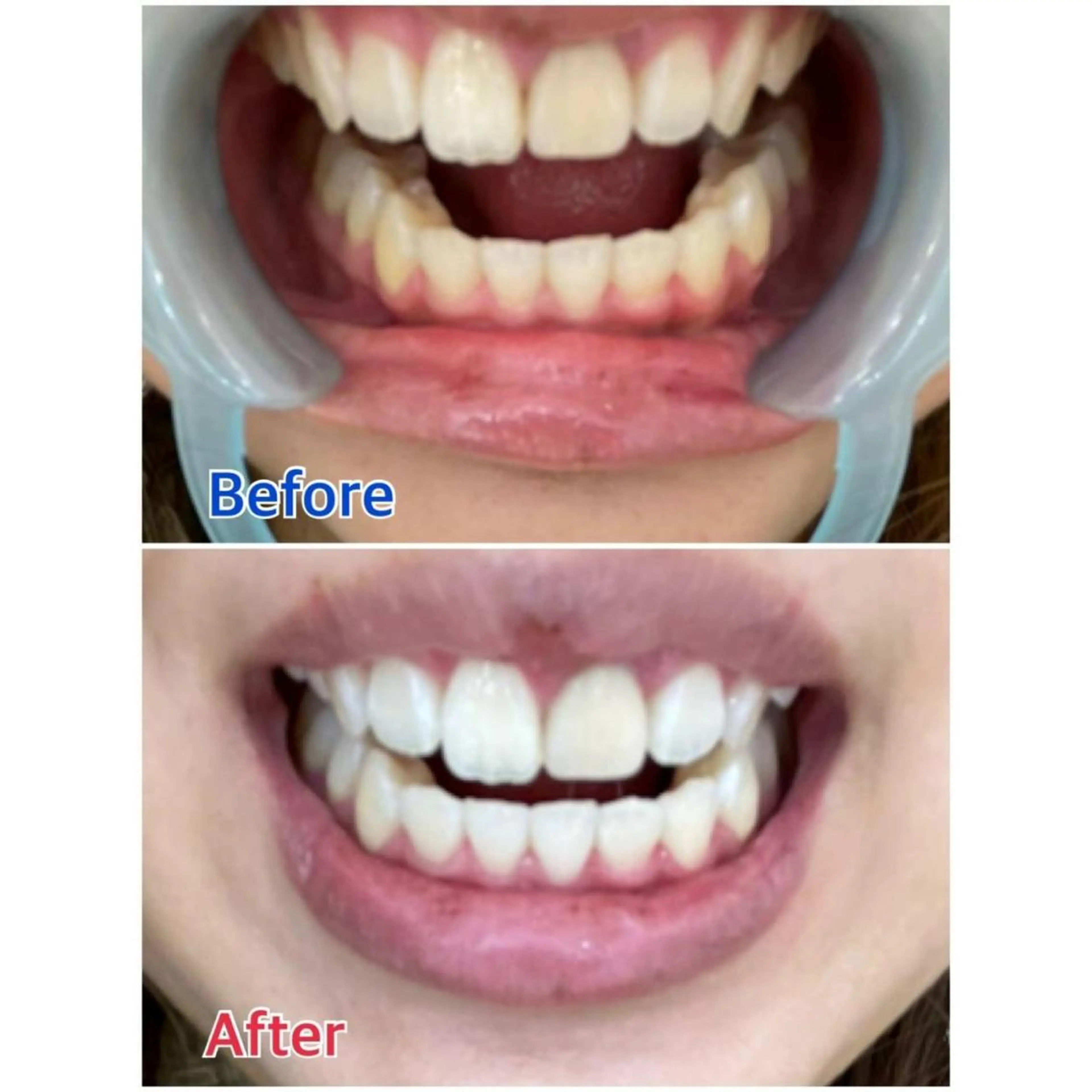 MBEAUTYSALON 千葉店・京成大久保所属・Melty 輝のその他イメージ