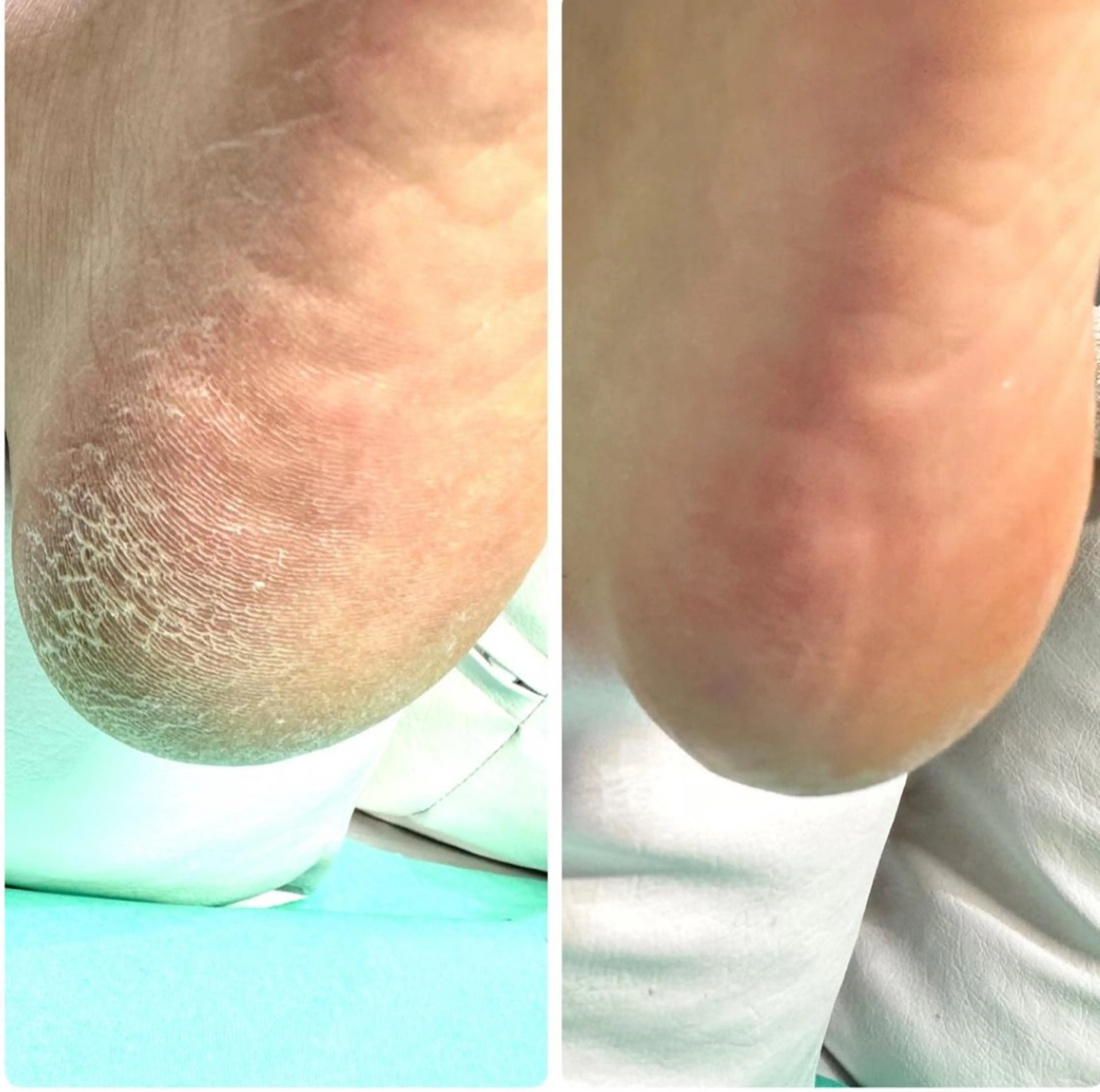 リラク 大宮巻き爪補正店所属・大宮 巻き爪補正店のエステ・リラクイメージ