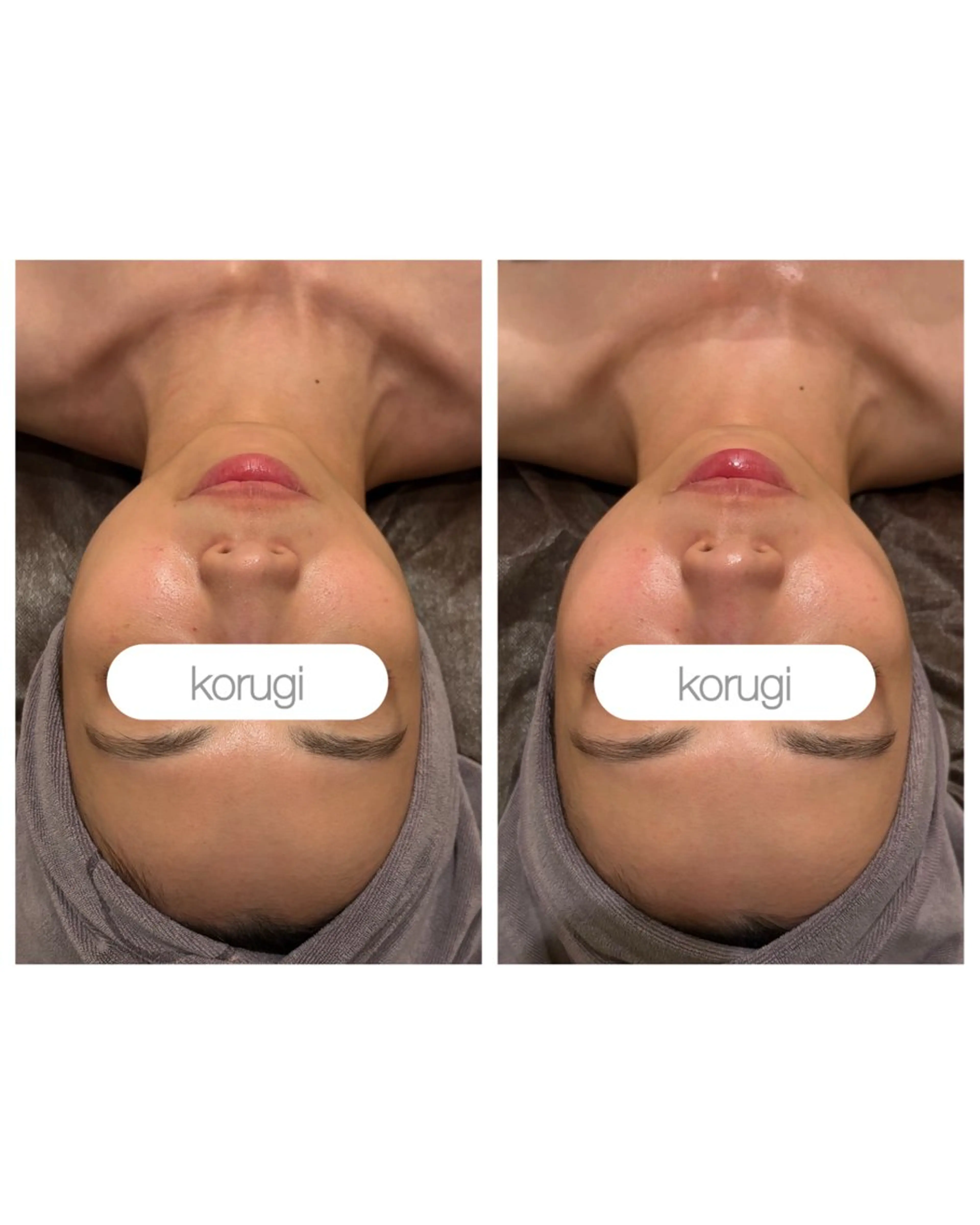 エステ リラク 肌質管理/小顔コルギ ☆表参道/外苑前のエステ・リラクイメージ