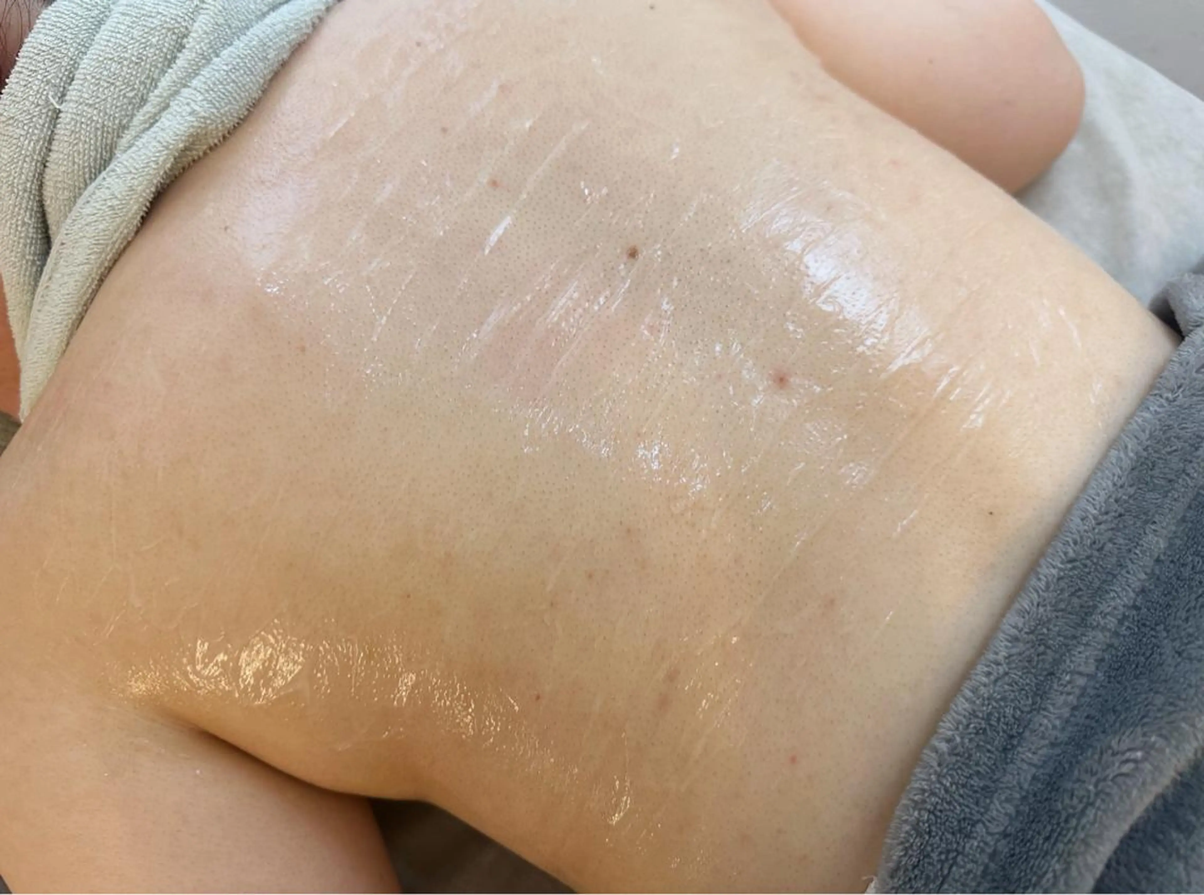 うなじ脱毛/美肌脱毛 LABELのエステ・リラクイメージ