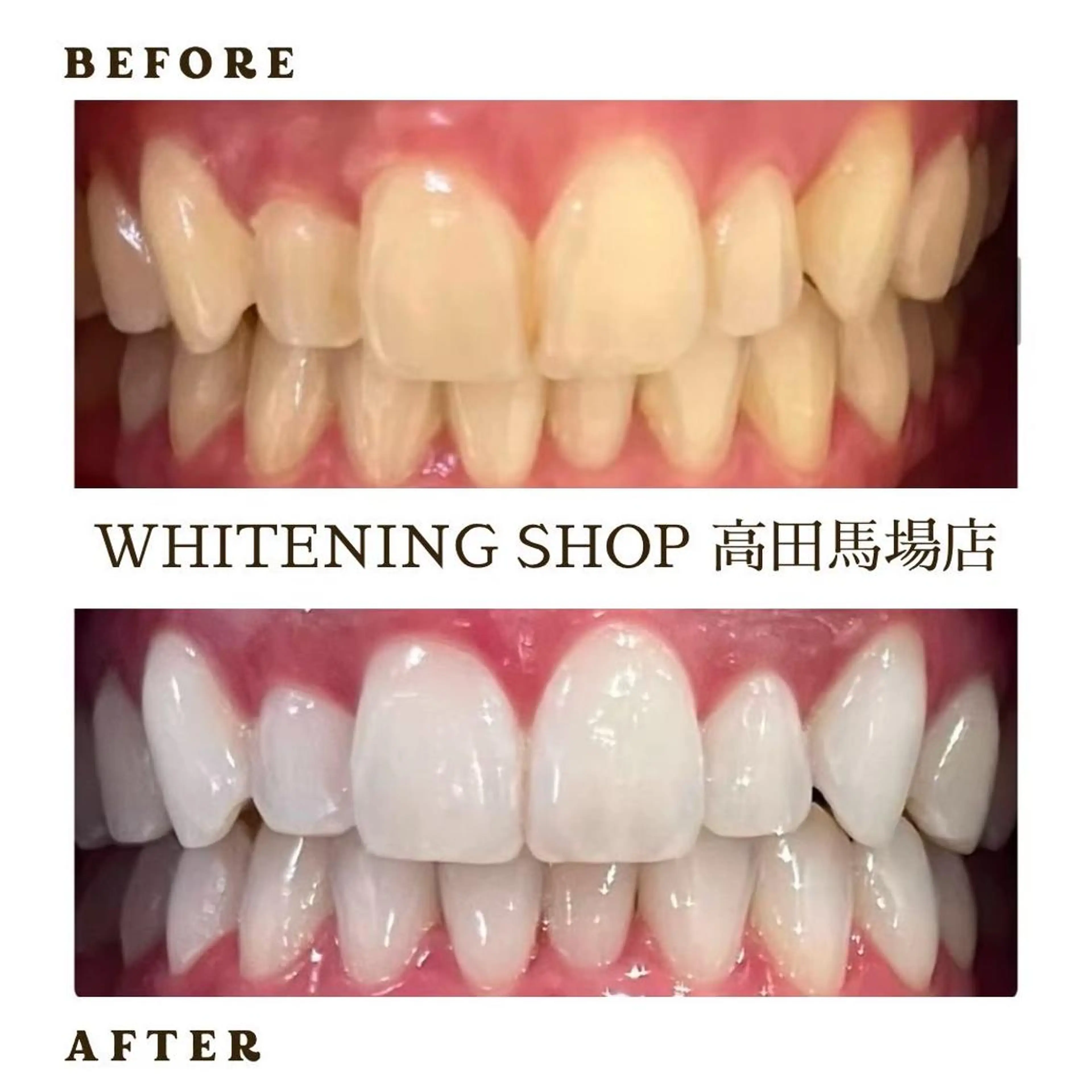 メンズ その他 ホワイトニング ショップ高田馬場店のその他イメージ