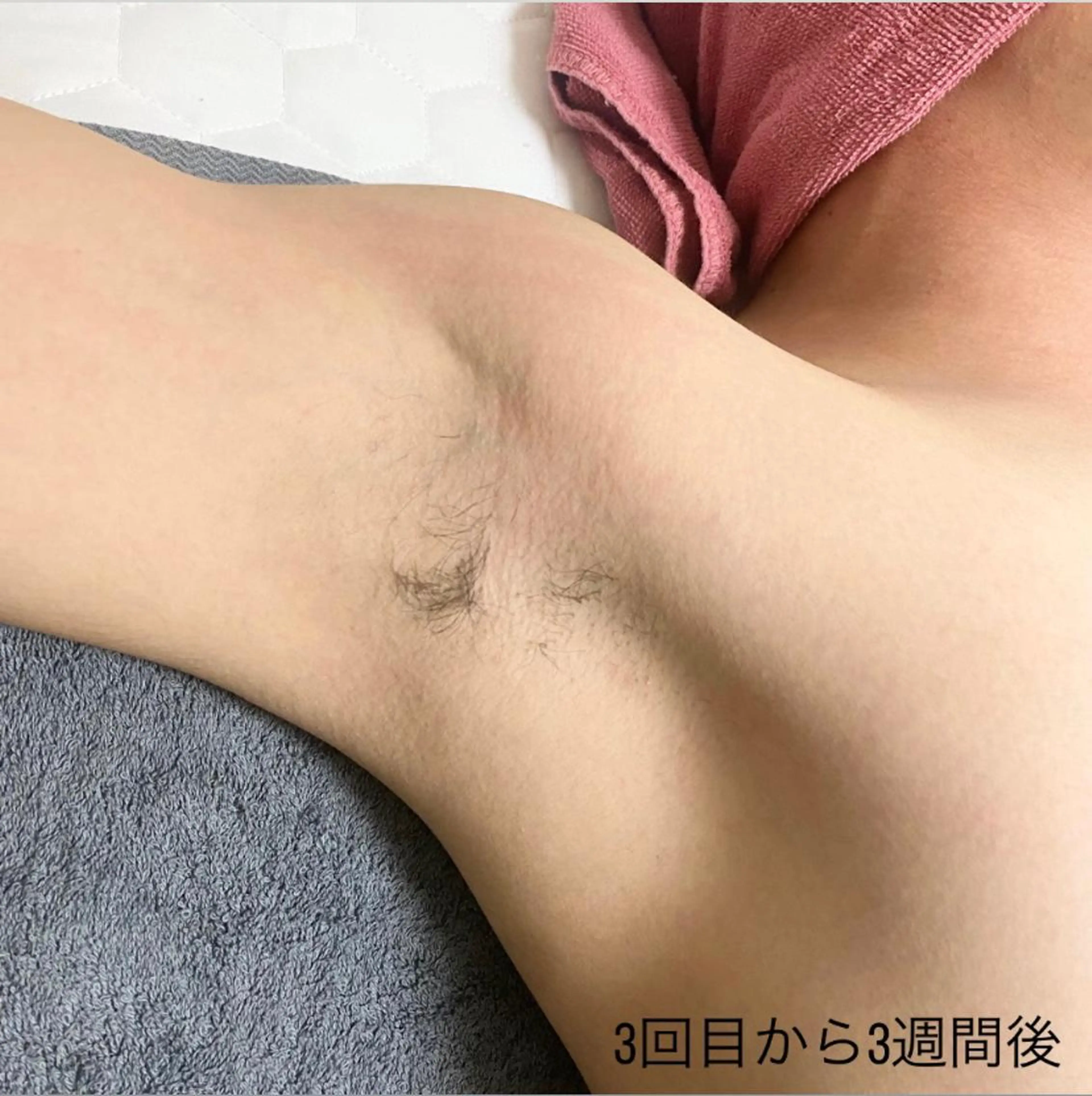 メンズ 美肌脱毛サロンGrande所属・別府脱毛サロン Grandeのエステ・リラクイメージ