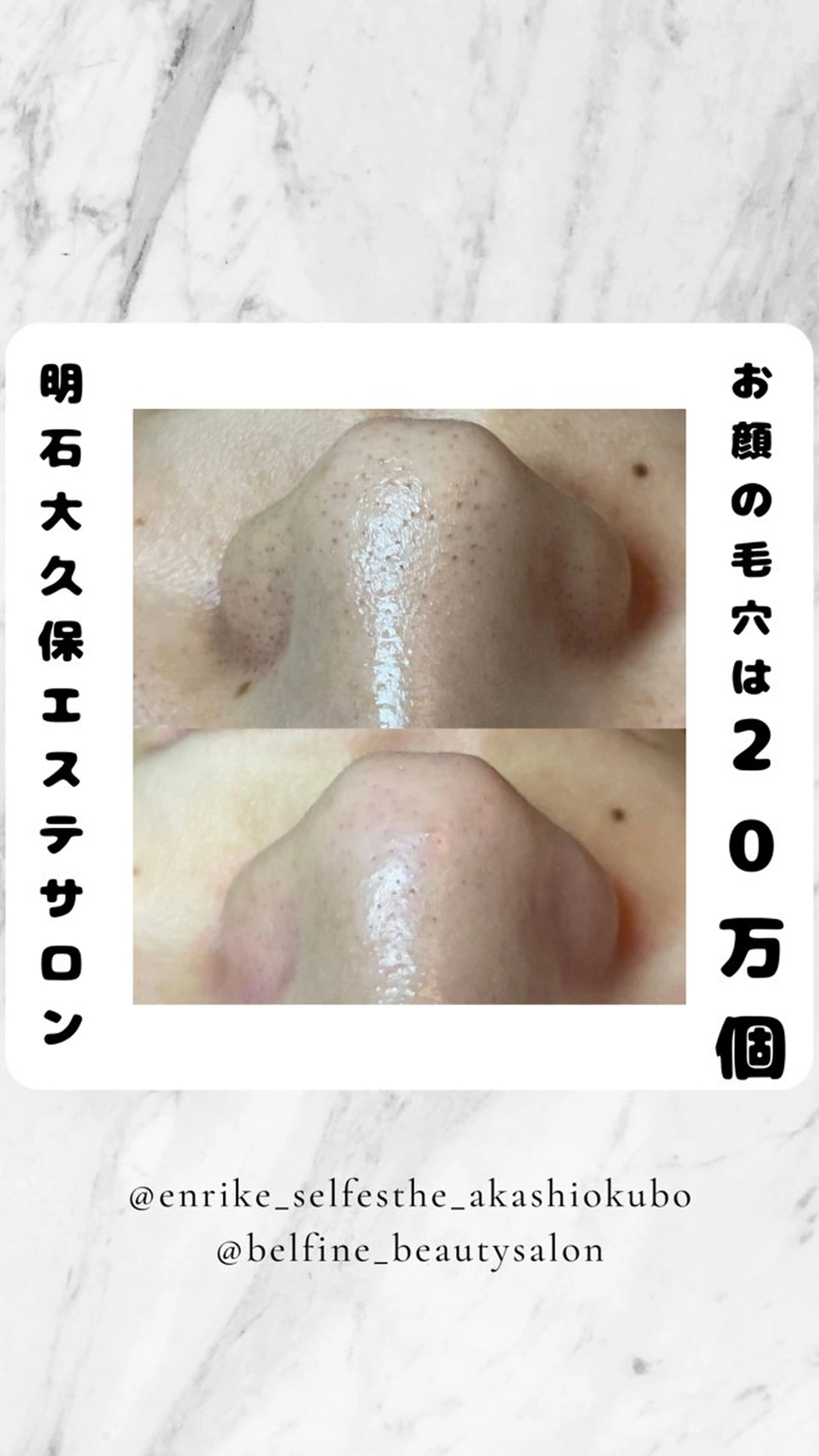 その他 セルフエステエンリケ明石大久保店所属・夕希リンパ&痩身& 脱毛&毛穴ケアのエステ・リラクイメージ