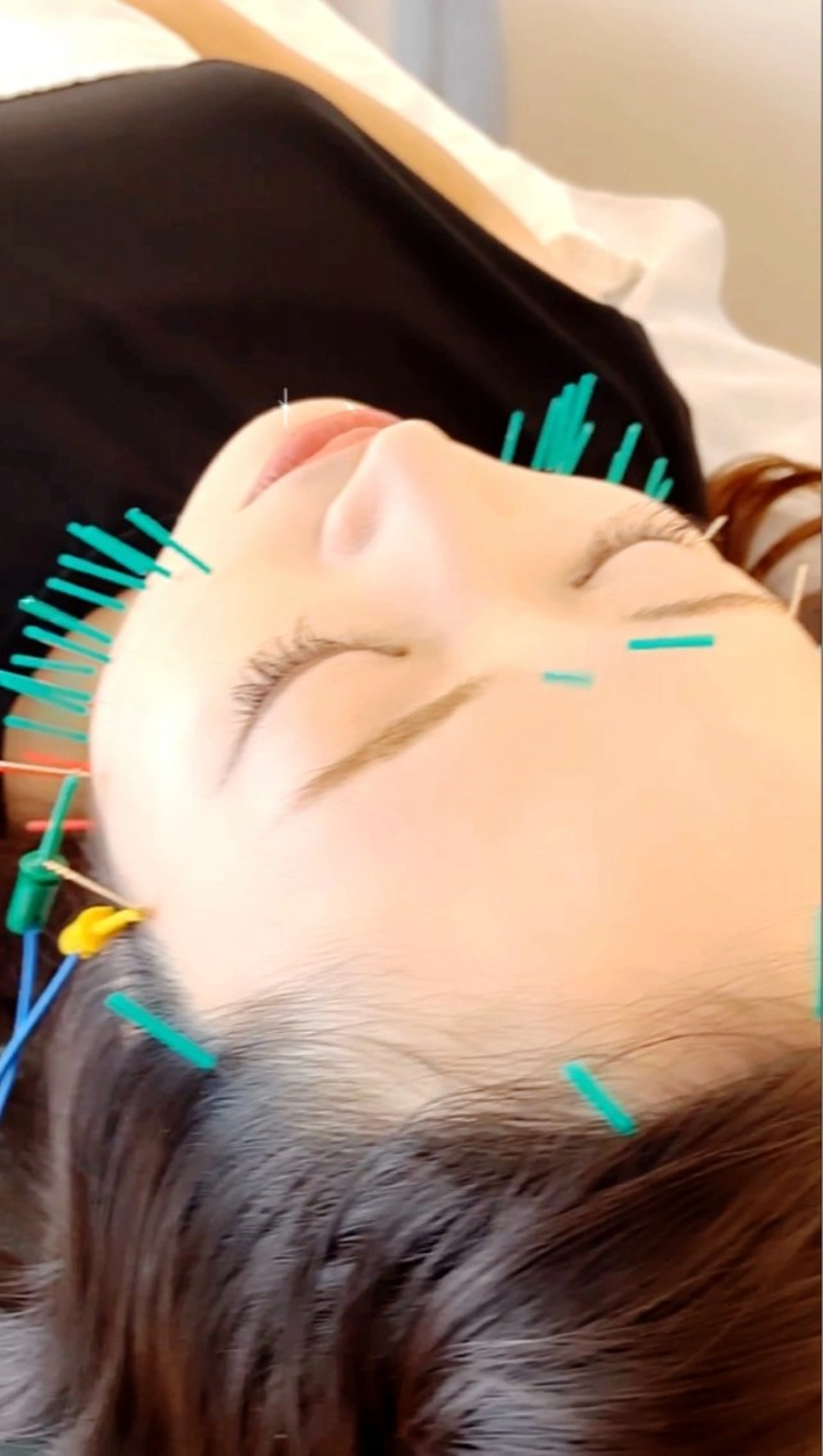 小顔美容鍼専門サロン 渋谷YZのエステ・リラクイメージ