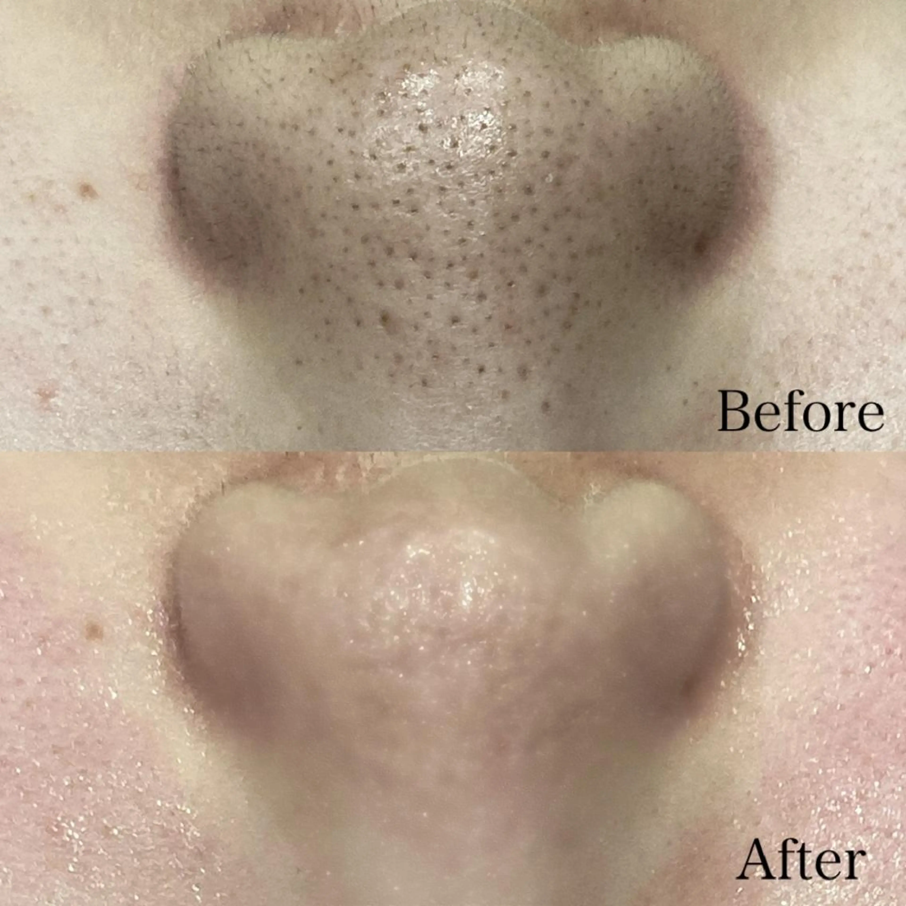 エステ DahliaBeauty ダリアビューティー所属・Dahlia 痩身 フェイシャル 中村のエステ・リラクイメージ