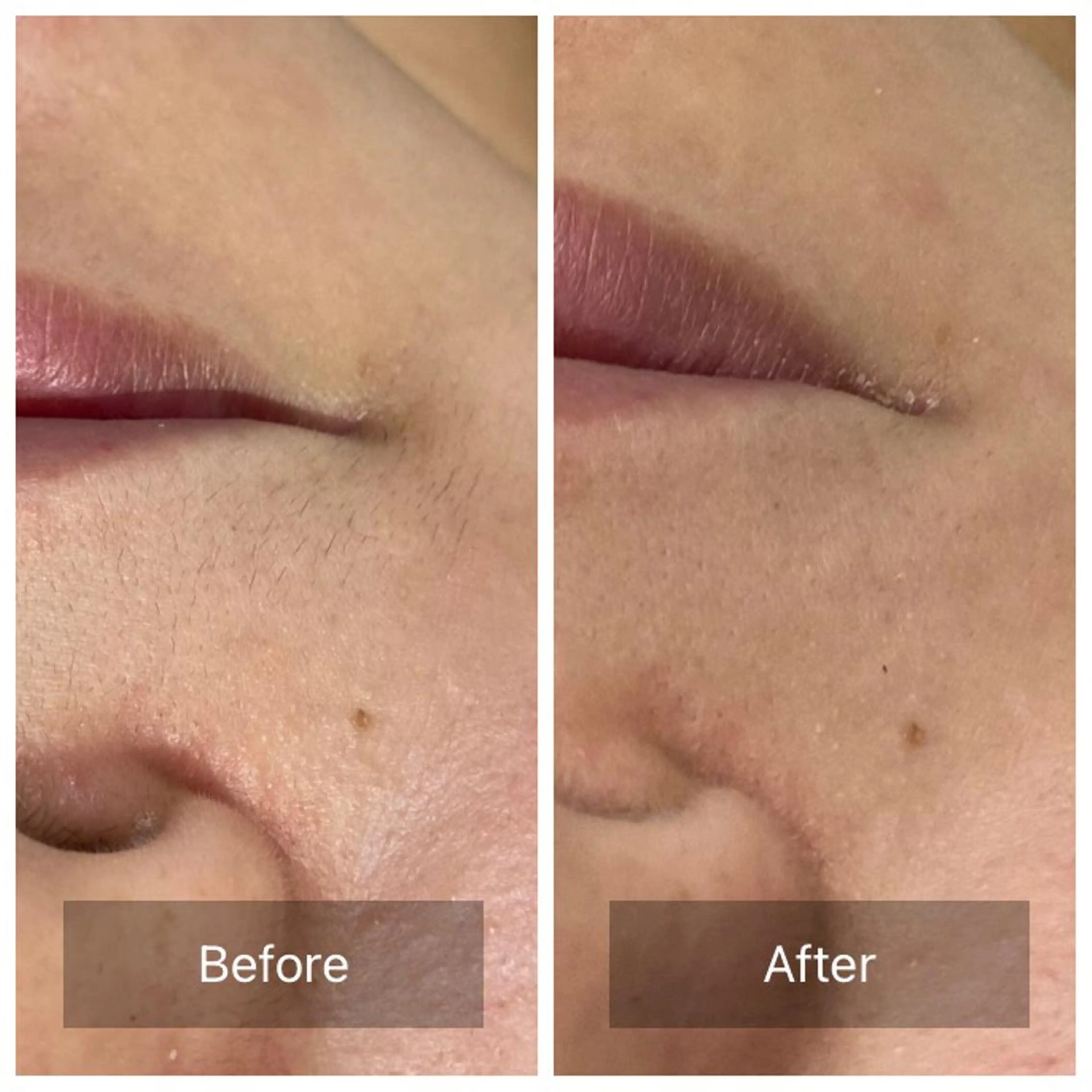 エステ 産毛専門店 Bittoのエステ・リラクイメージ