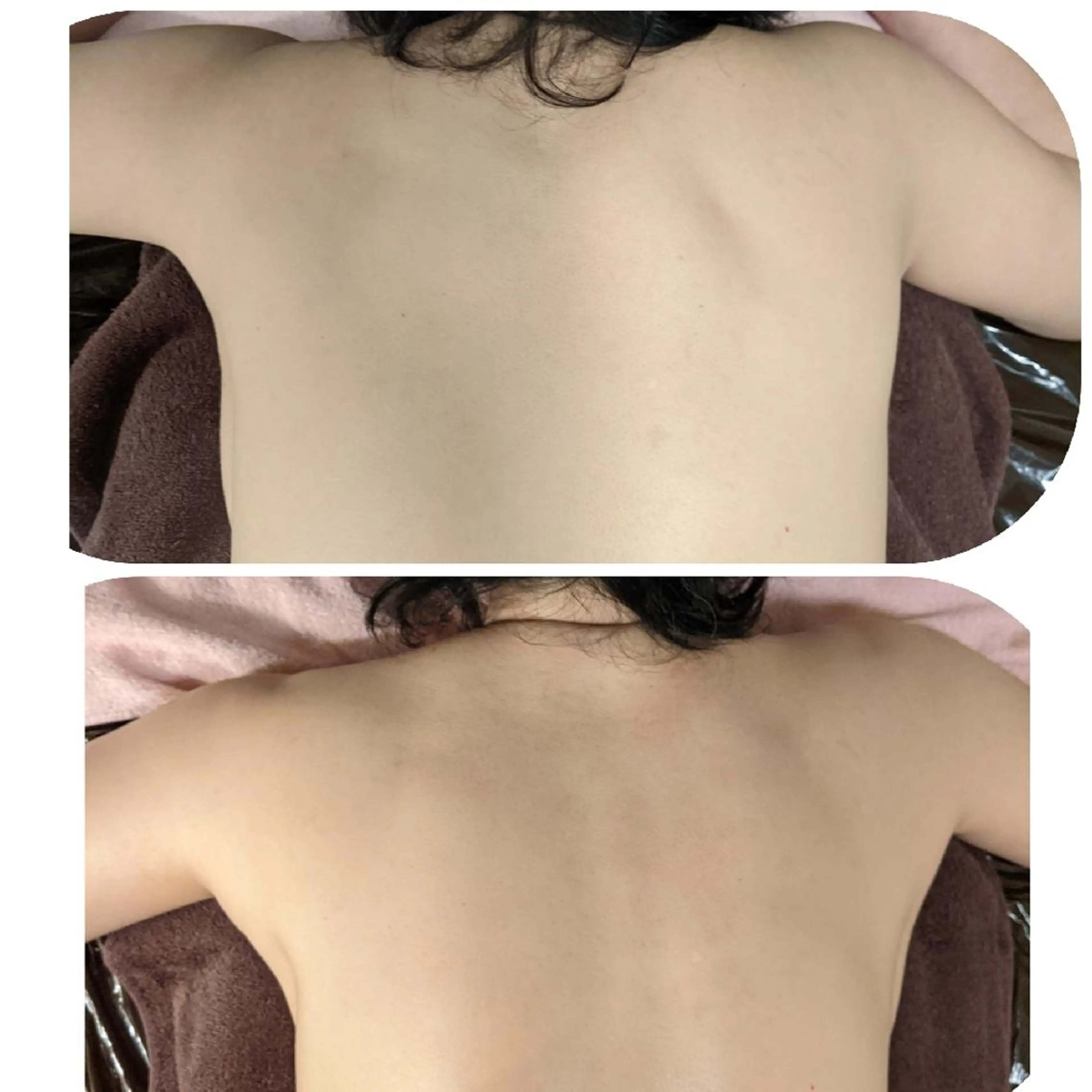 整体エステ　NEW ME所属・深層リンパオイル/小 顔とドライヘッドスパのエステ・リラクイメージ