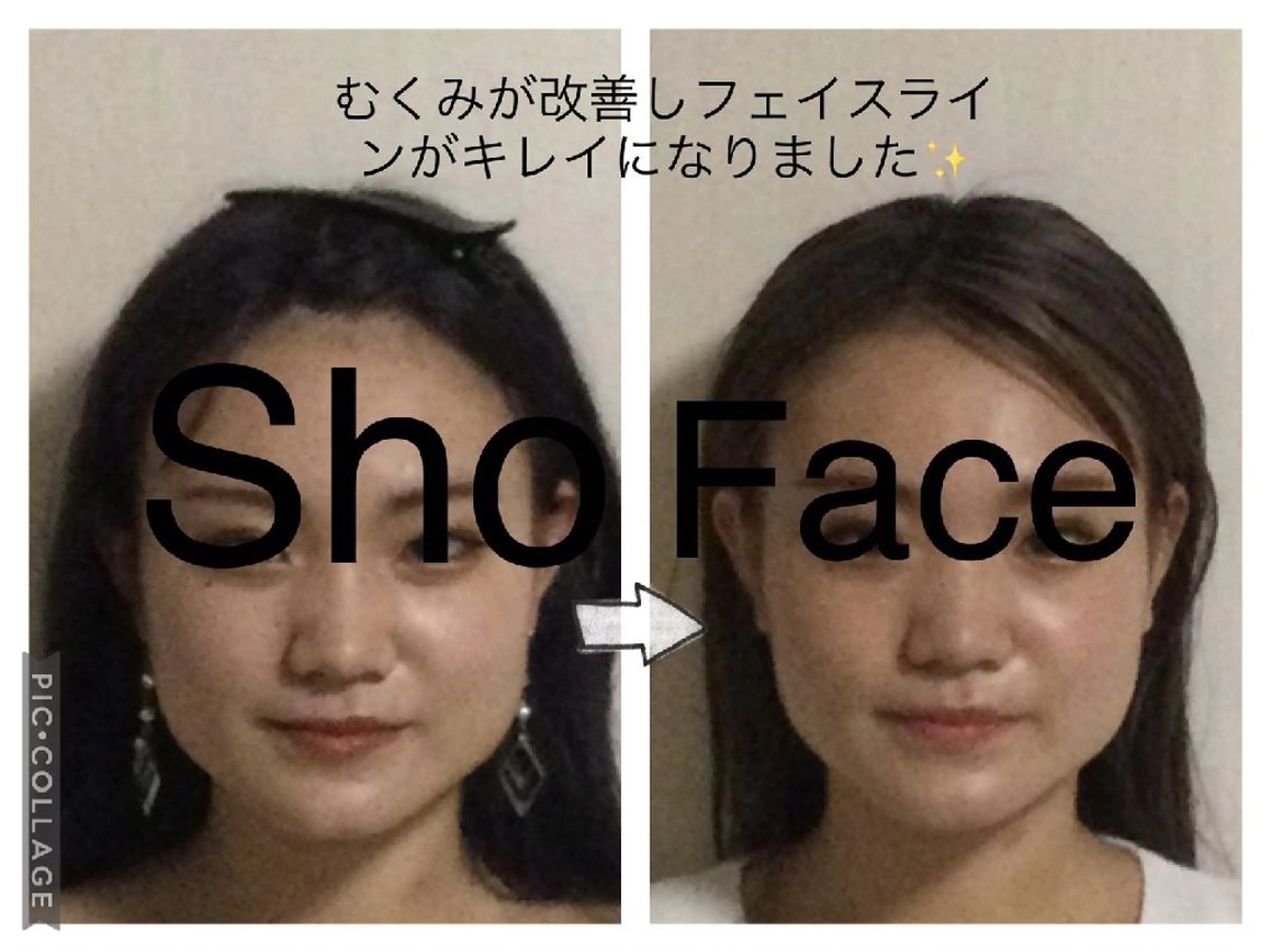 エステ リラク 小顔矯正Sho  FaceDesignのエステ・リラクイメージ
