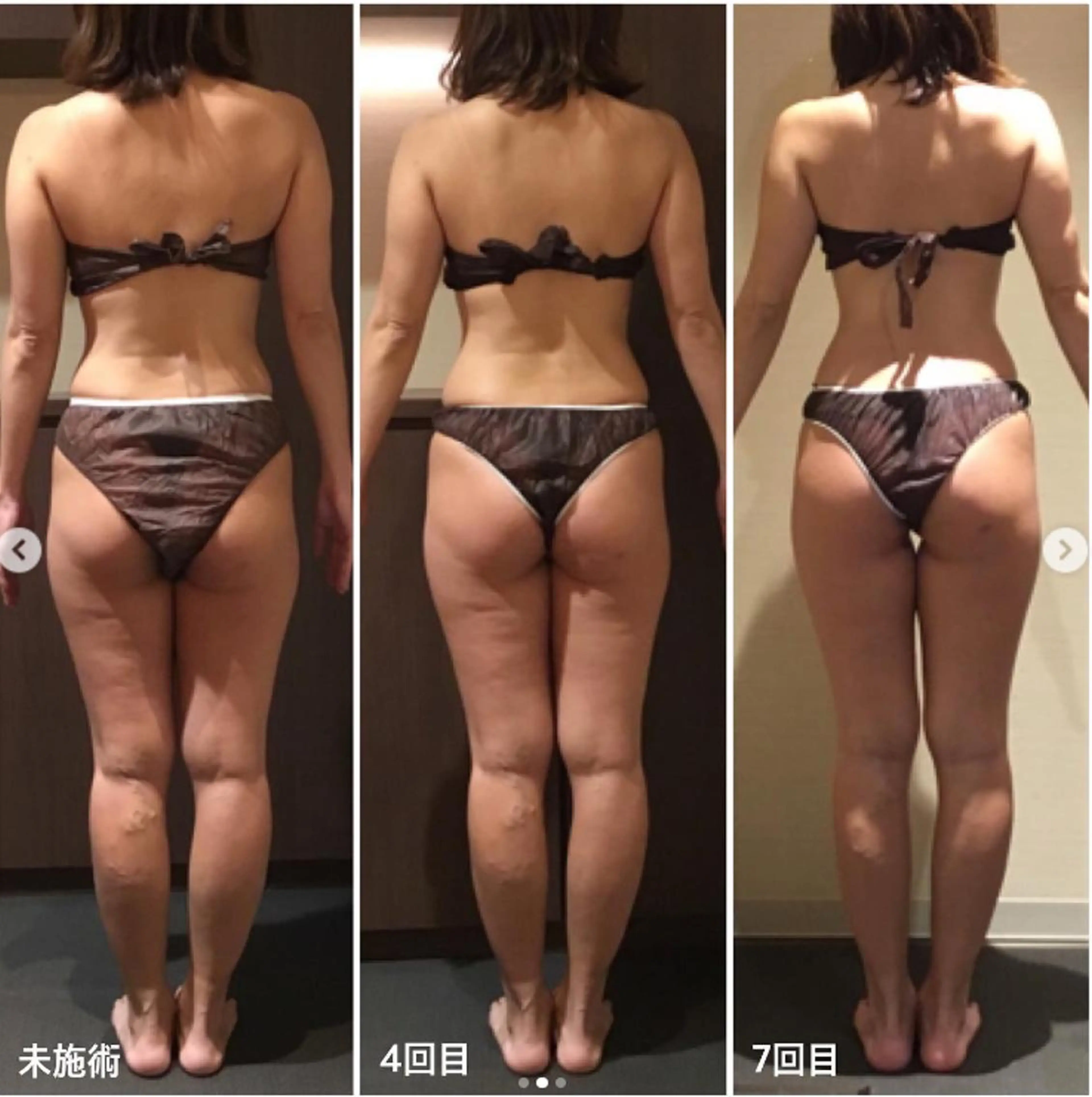 1日1名限定【ご新規様BODYモニター体験】80分¥33000→¥8800の写真