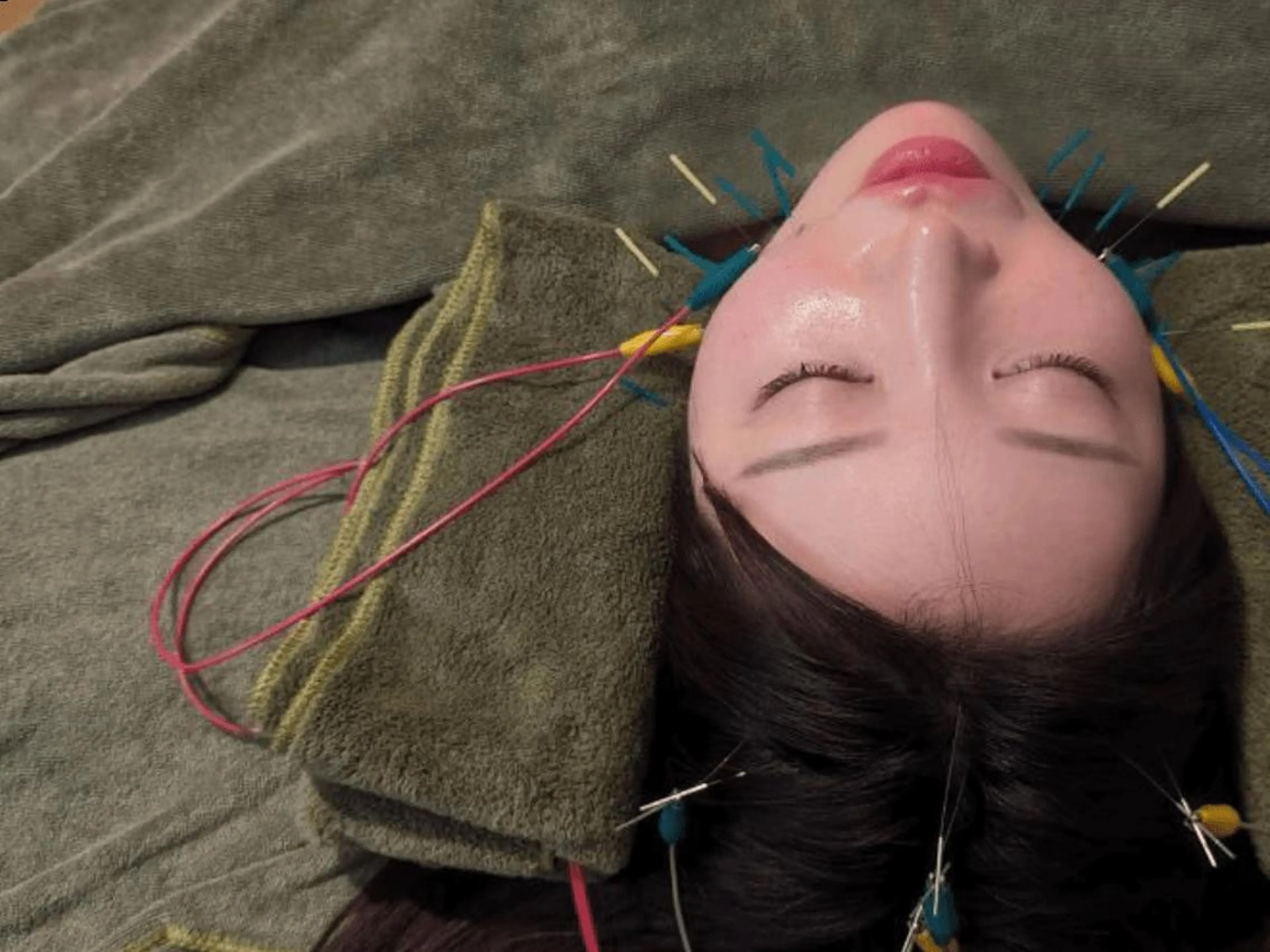 エステ リラク 美容とカラダの鍼灸 サロン やなけんのエステ・リラクイメージ