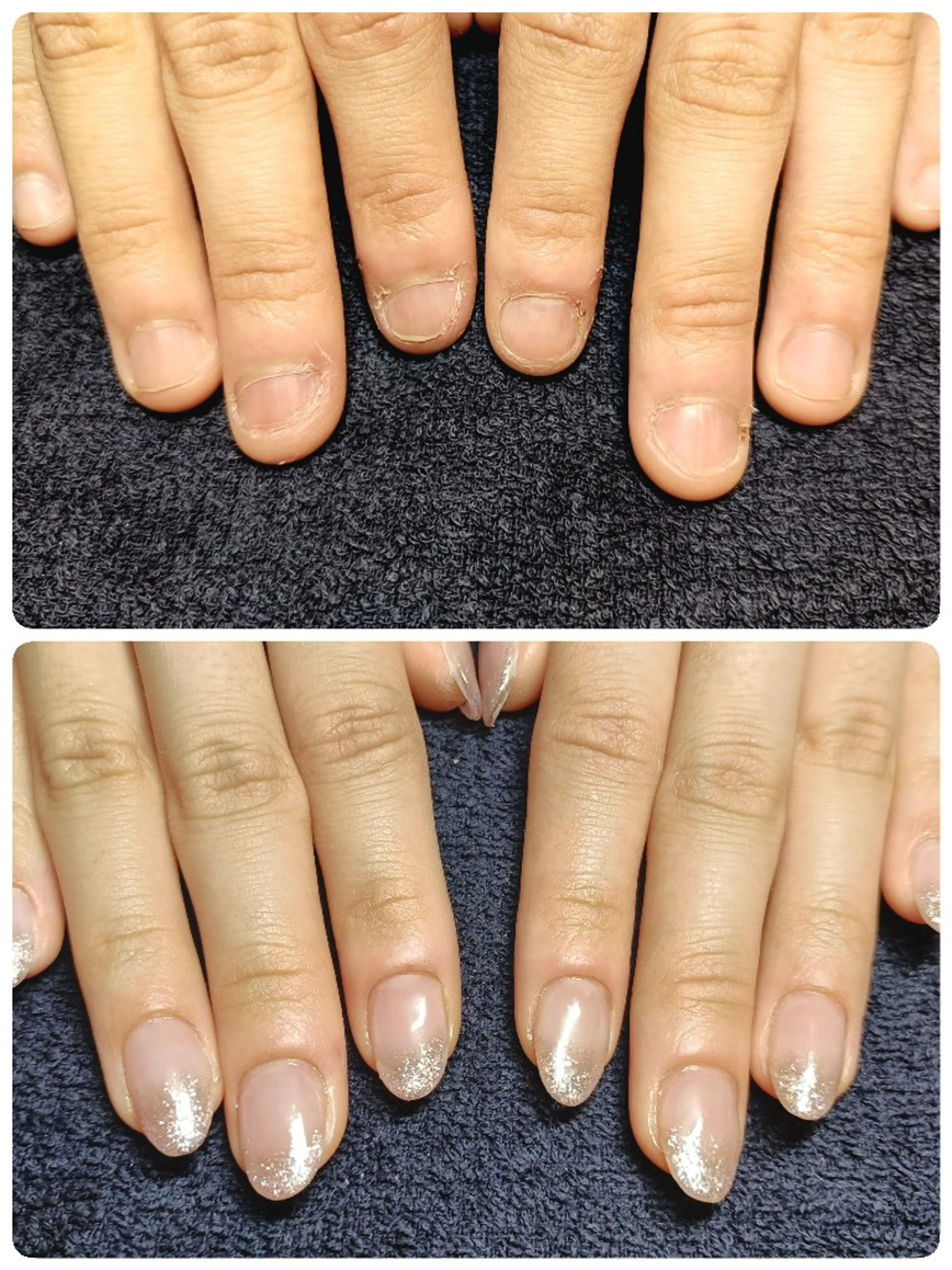 ネイル 長さ出し ハンドネイル ハンドケア 深爪矯正/爪育成ケア manie nailのネイルデザイン