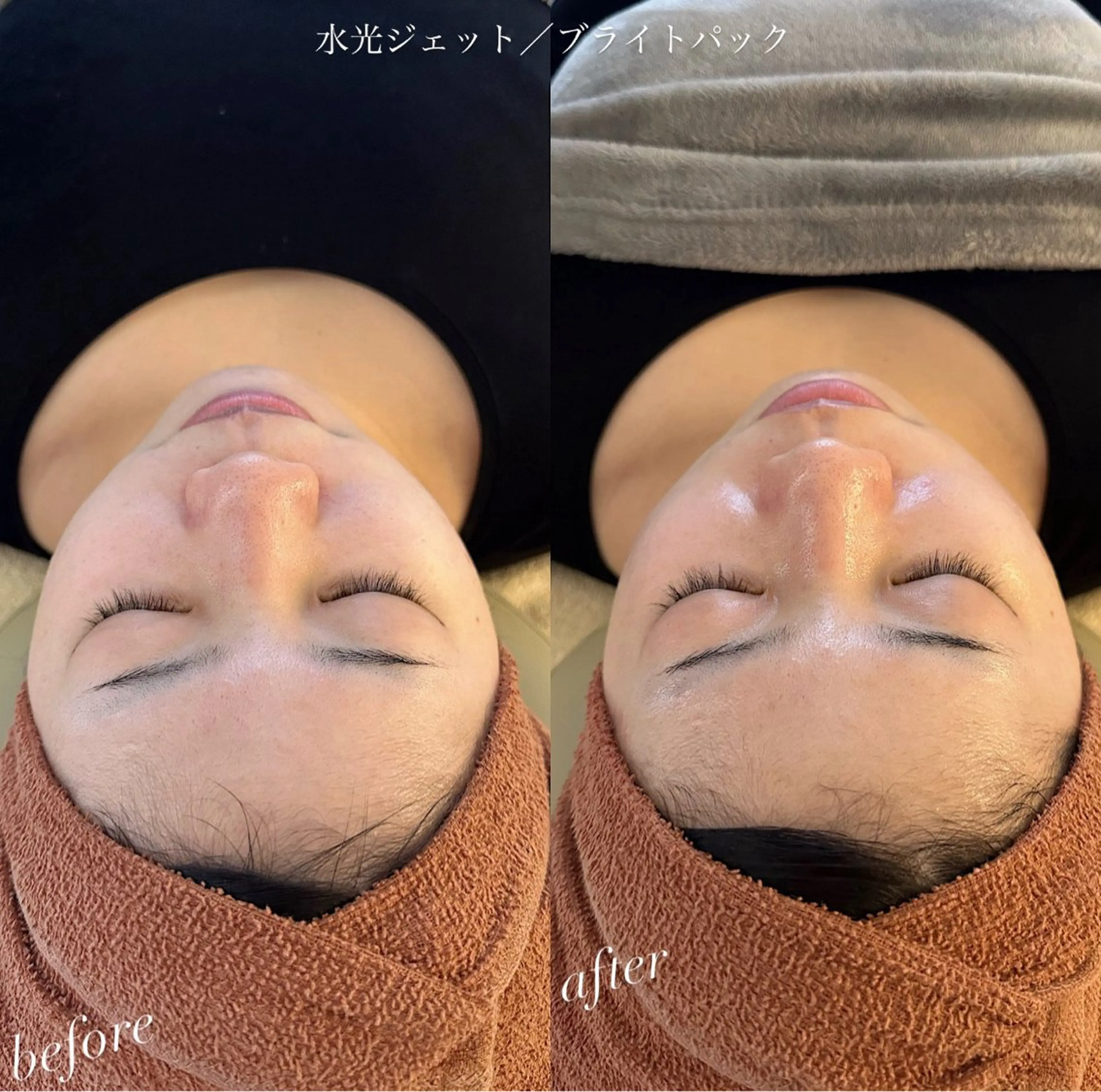 エステ うなじ脱毛/美肌脱毛 LABELのエステ・リラクイメージ