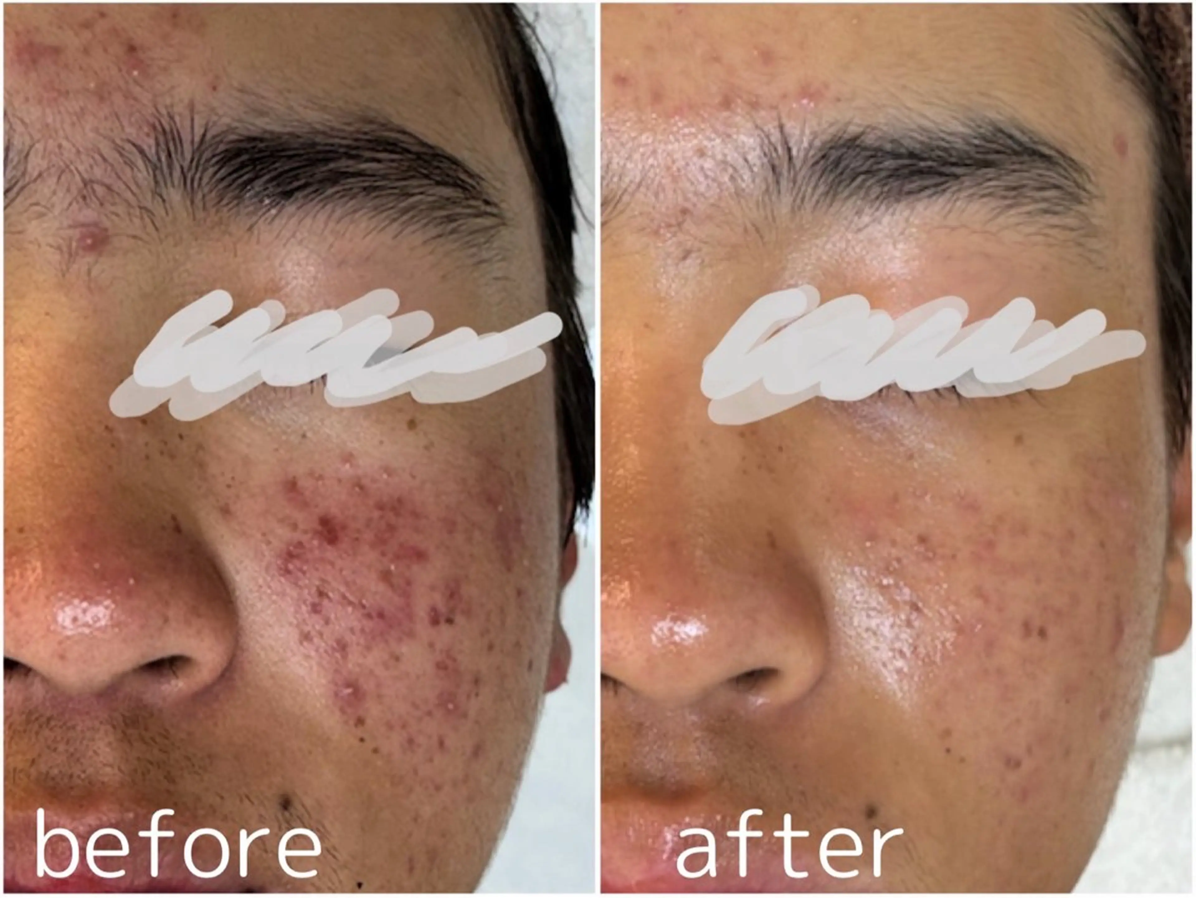 エステ リラク 田中For..天王寺 肌質改善/よもぎ蒸しのエステ・リラクイメージ