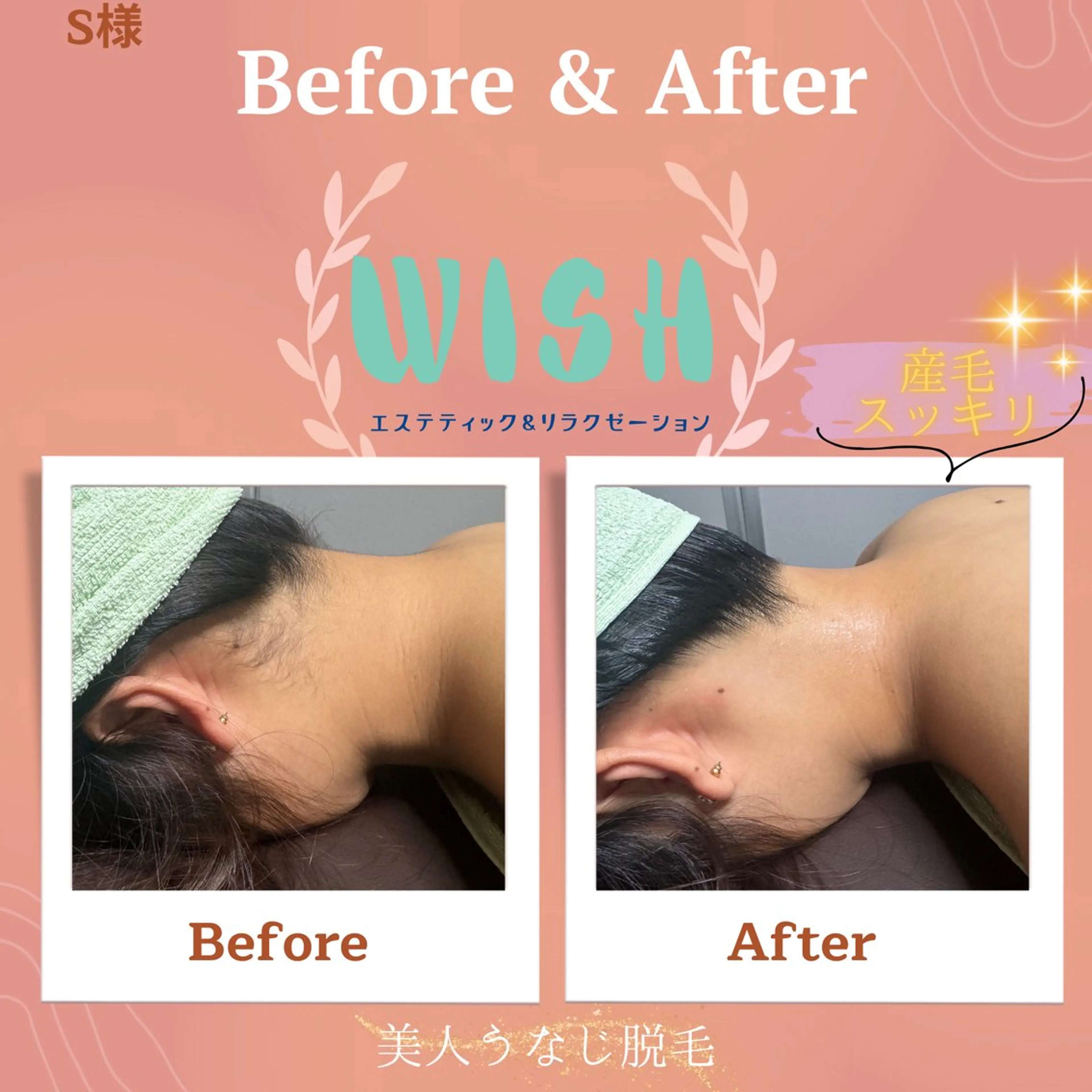 WISH 美肌脱毛のプロ！須藤のエステ・リラクイメージ