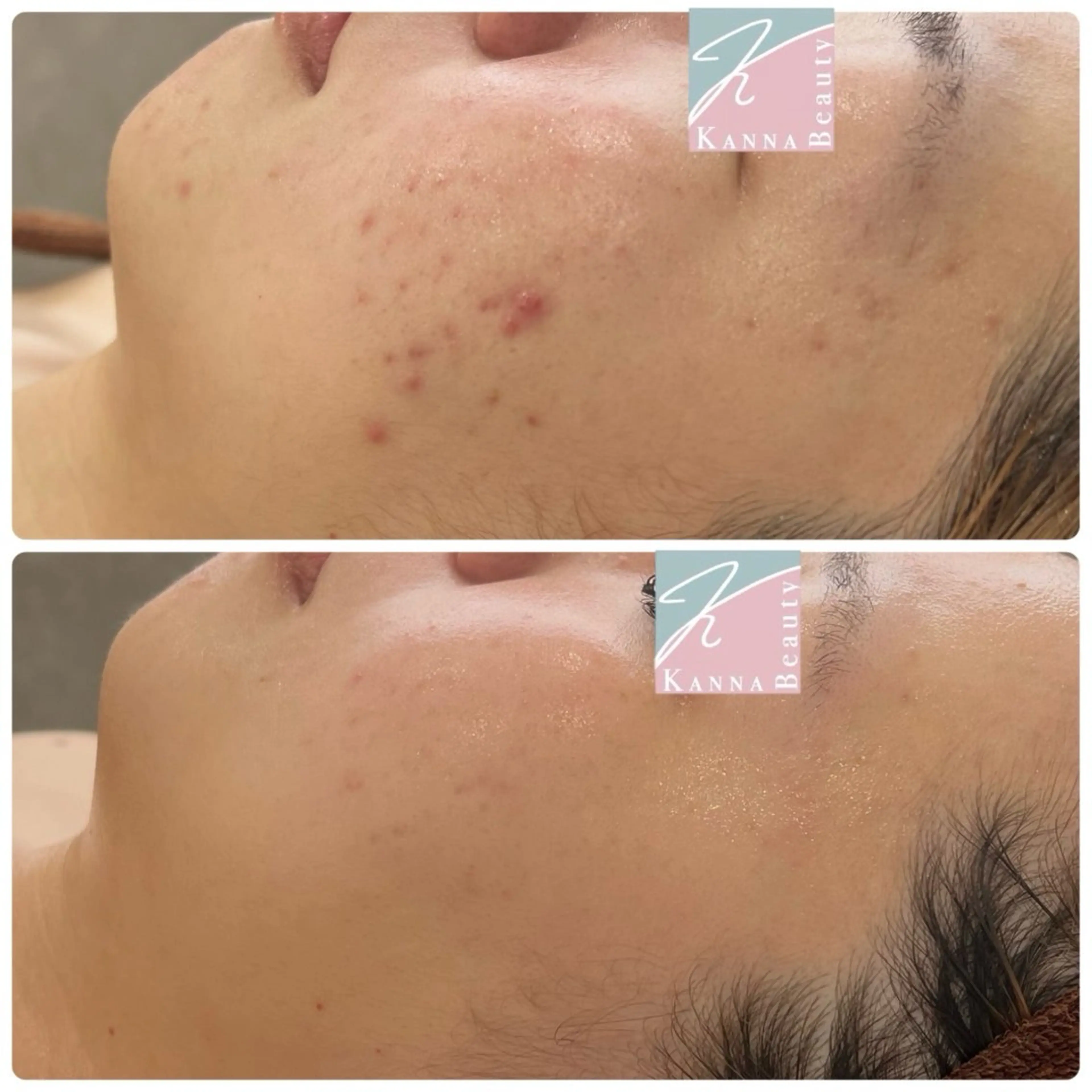 タラソトリートメント👳‍♀️✨の写真