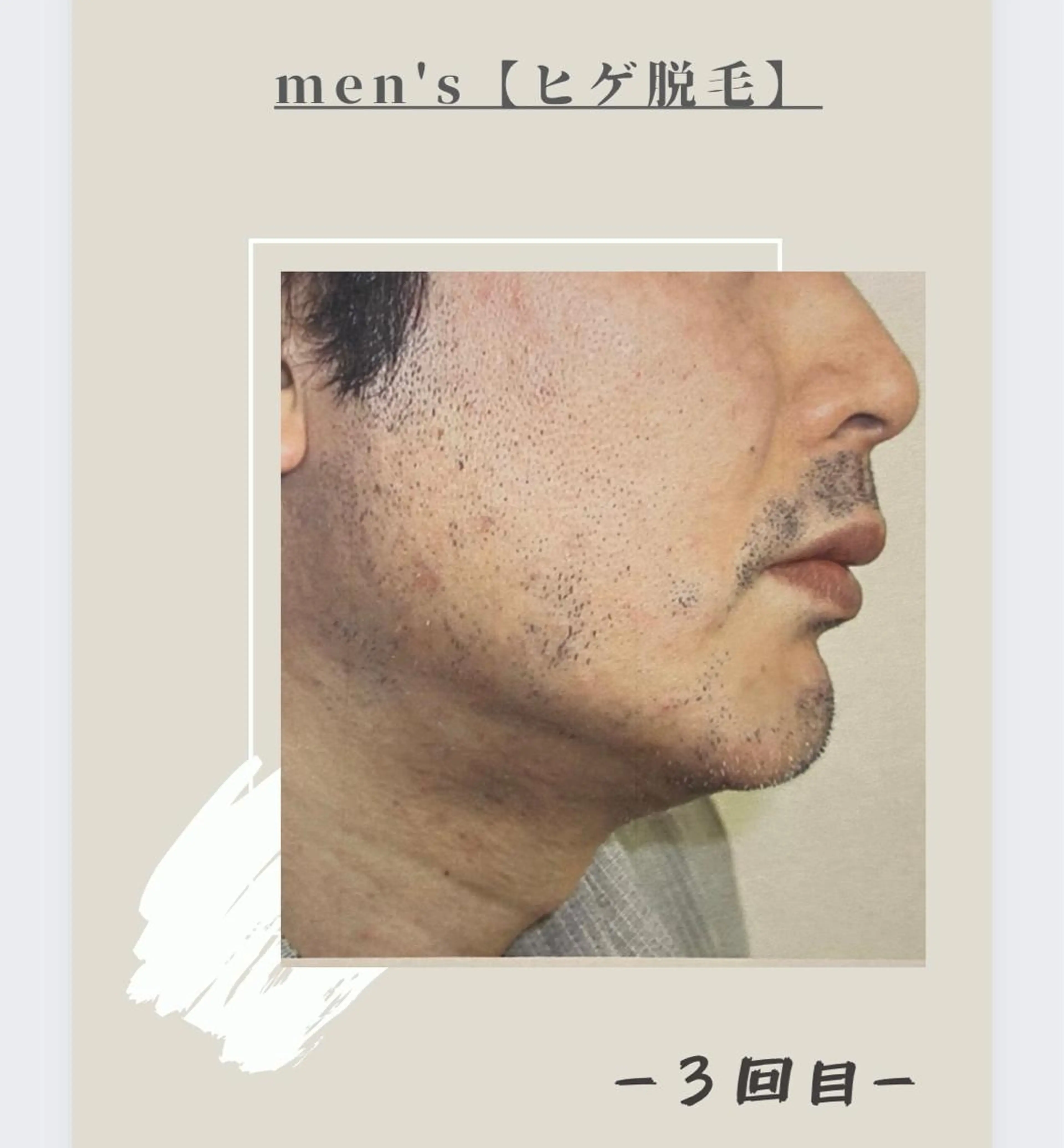 メンズ 女性専用脱毛サロン エンジェルナンバーのエステ・リラクイメージ