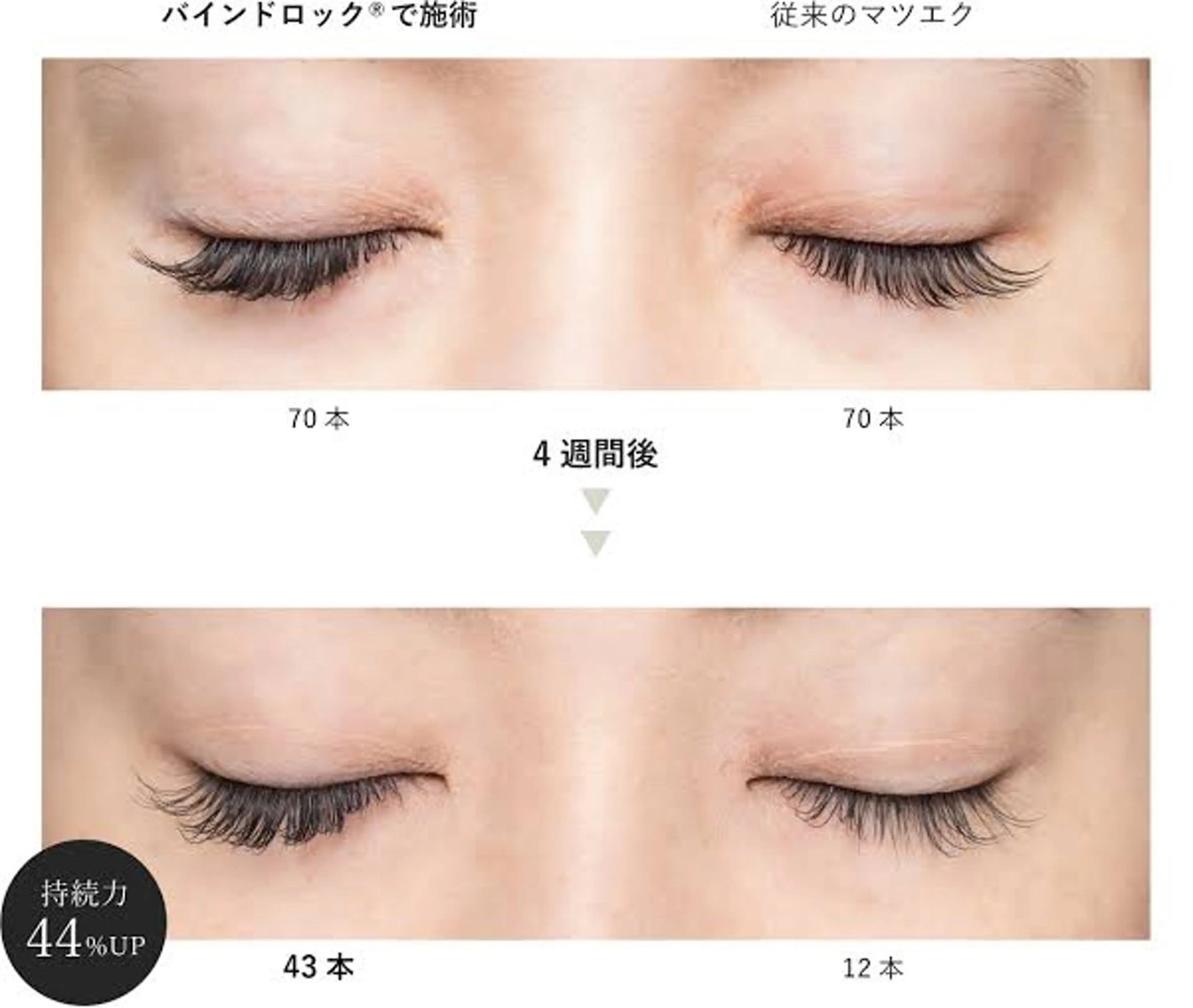 バインドロック40束の写真