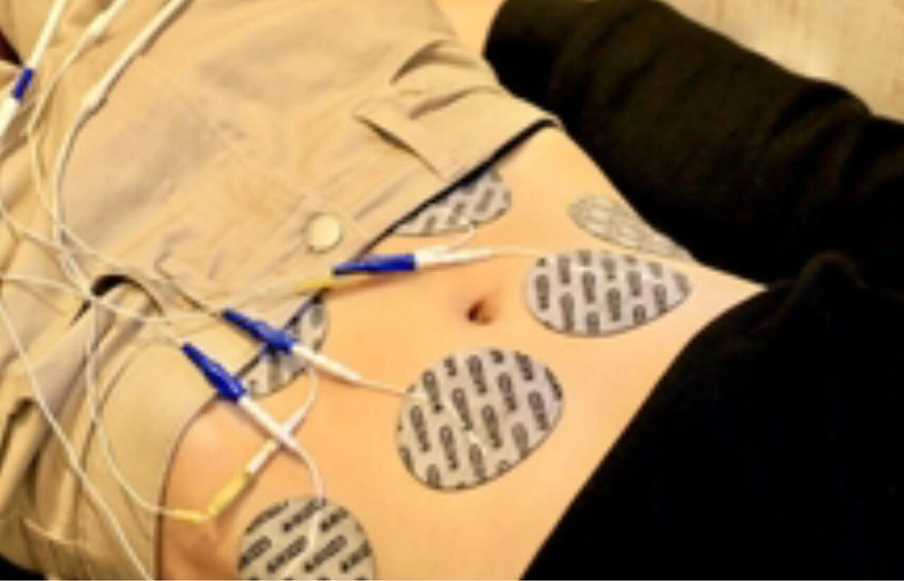 痩身レベル★★★★★😲✨【運動が苦手な方へ】ハイパーナイフ+シェイプ+EMS×岩盤ヒートマット　痩身エステの写真