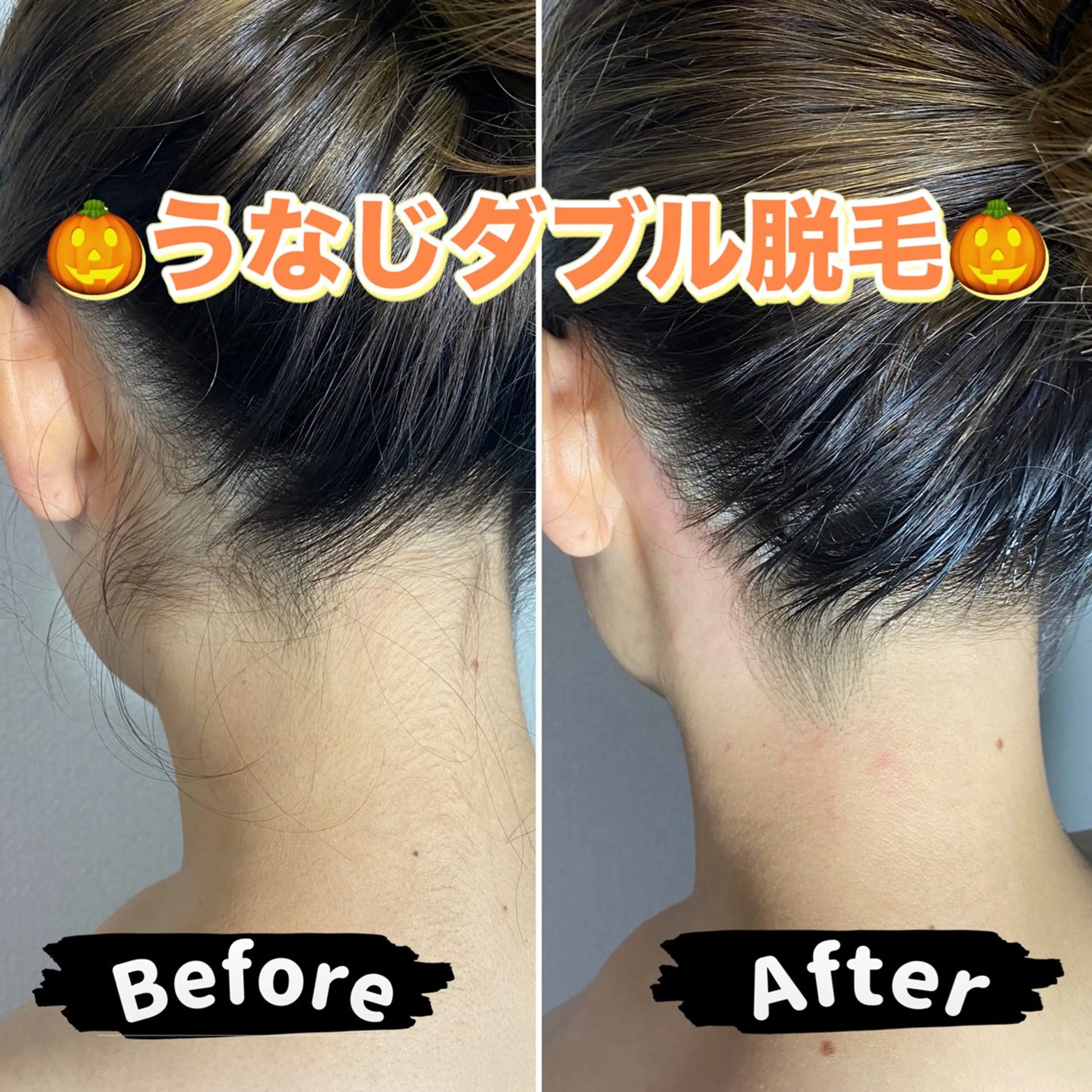 エピナス町田店 ブラジリアンワックスのエステ・リラクイメージ