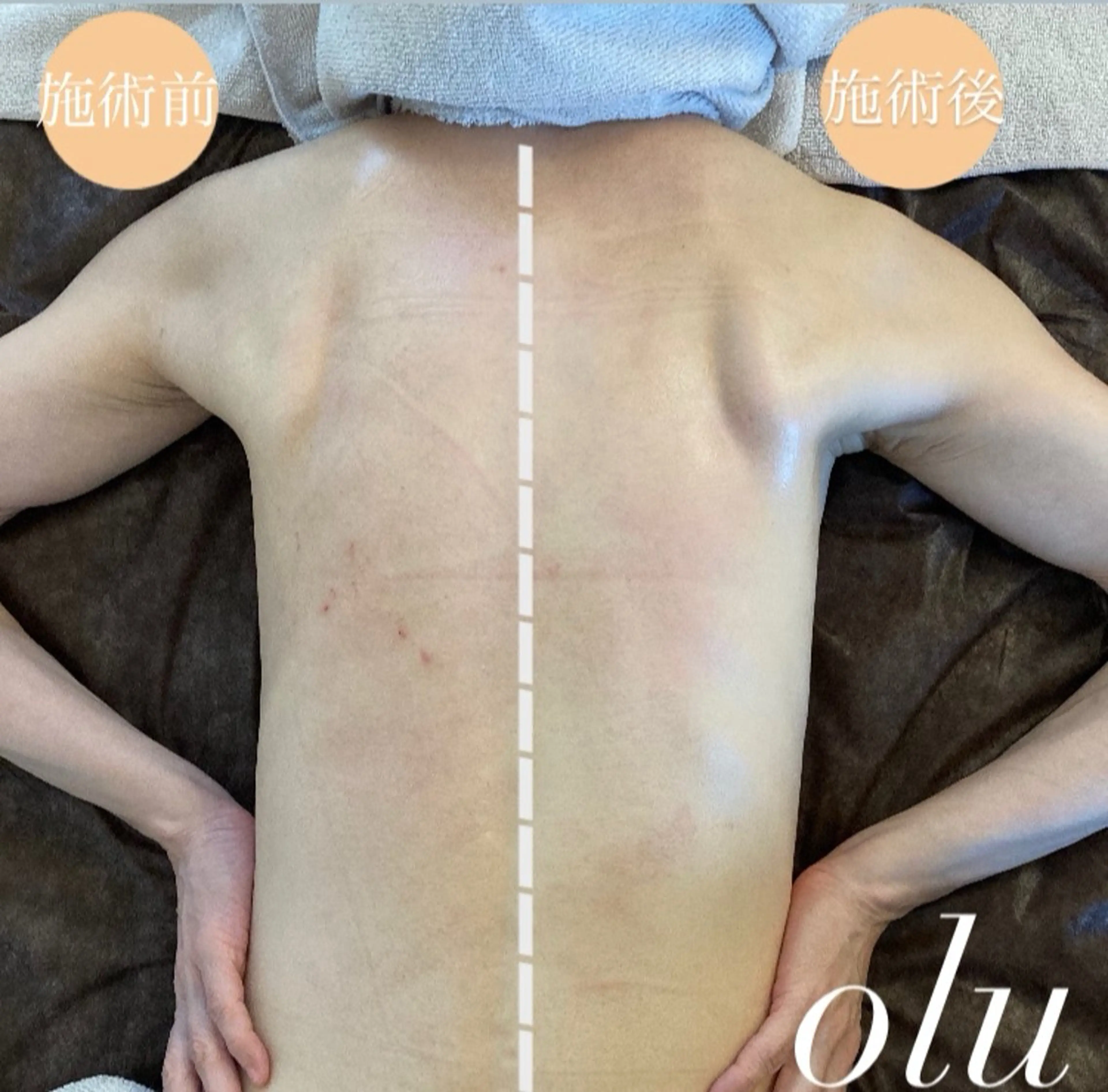 olu所属・リンパトリートメント oluのエステ・リラクイメージ