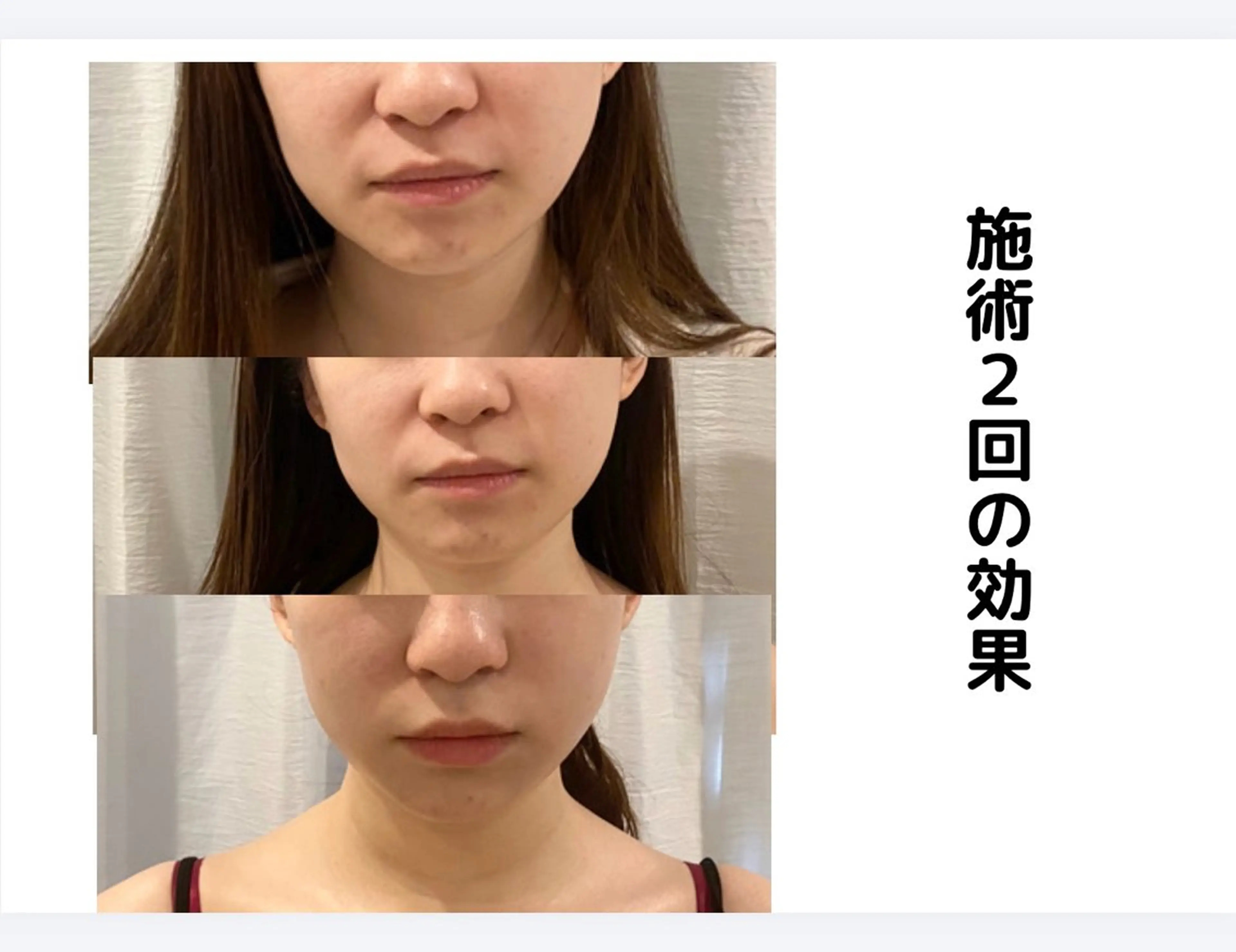 18%off90分12回クリスマス・成人式イベント小顔コルギの写真